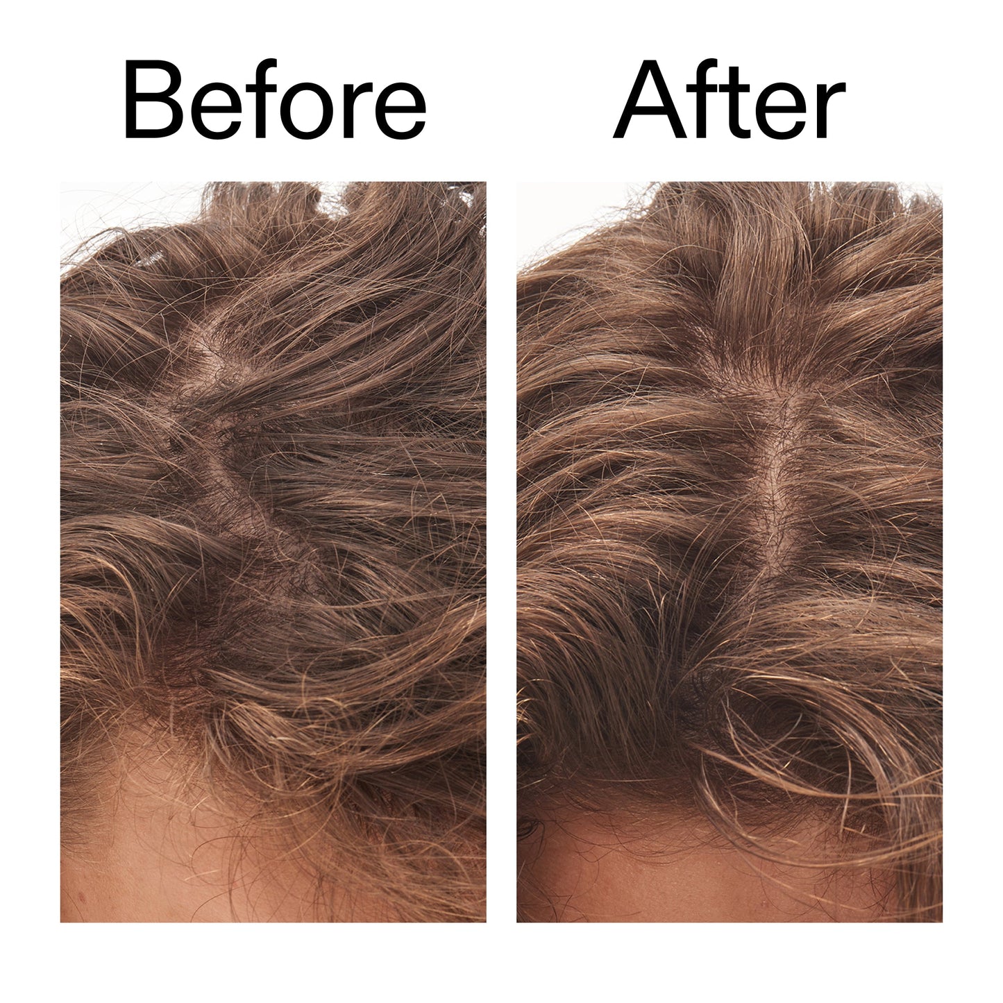 glycolic-acid-exfoliating-scalp-scrub-p2 Glycolic_Acid_Exfoliating_Scalp_Scrub_Before_After_2000x2000_b8561c87-05a1-4caa-80f7-1b6b33d750f7.jpg