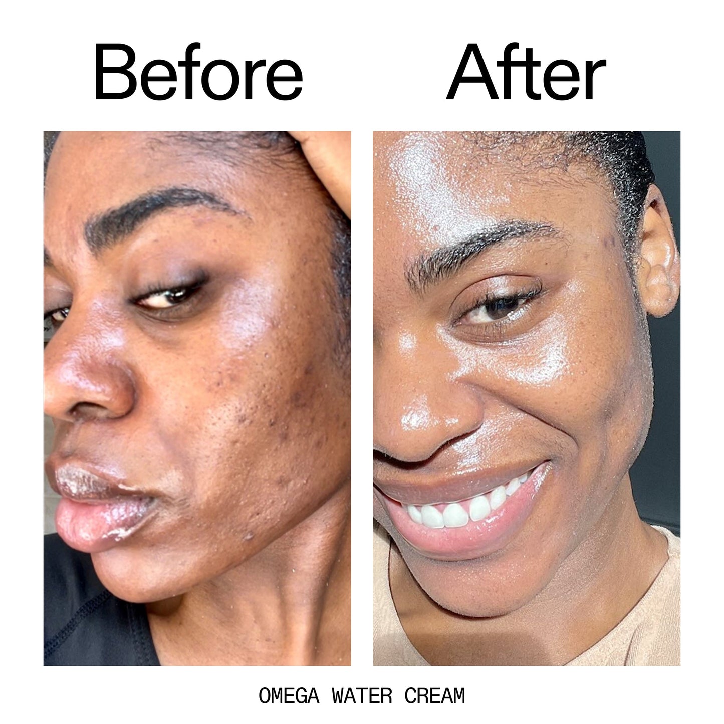glowing-skin-set-q3 Omega_Water_Cream_Before_After_2000x2000_8e88278b-8c8d-48dc-ac77-4e98ebbd1b77.jpg
