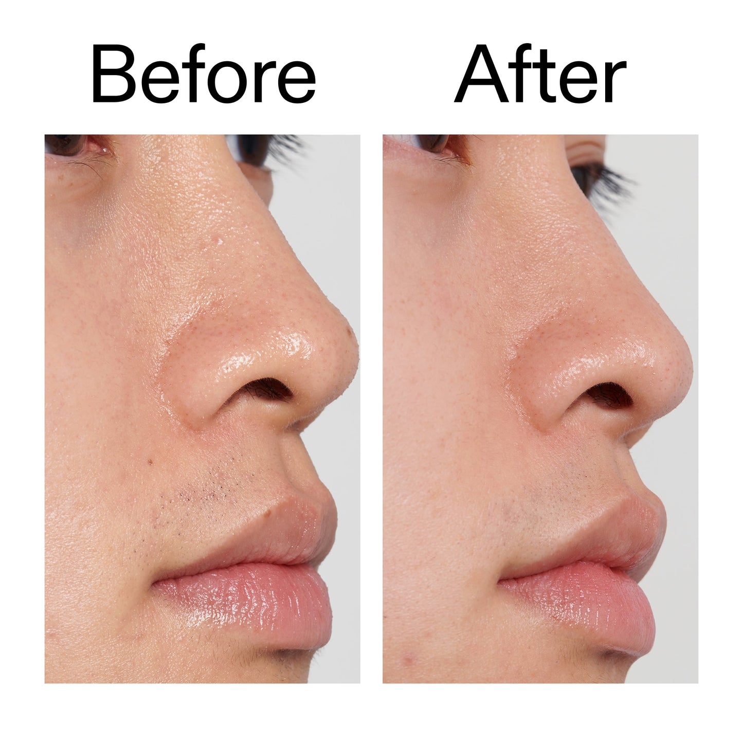 pha-toner-e8 PHA_Toner_Before_After_2000x2000_e3c10172-0150-4342-8b95-57417eaff50d.jpg