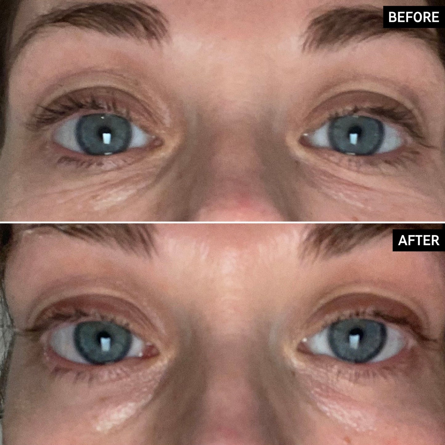 retinol-eye-cream-v9 SITE-UGCBAsApril_Nicole_B_A_PPage_2000x2000_1.jpg