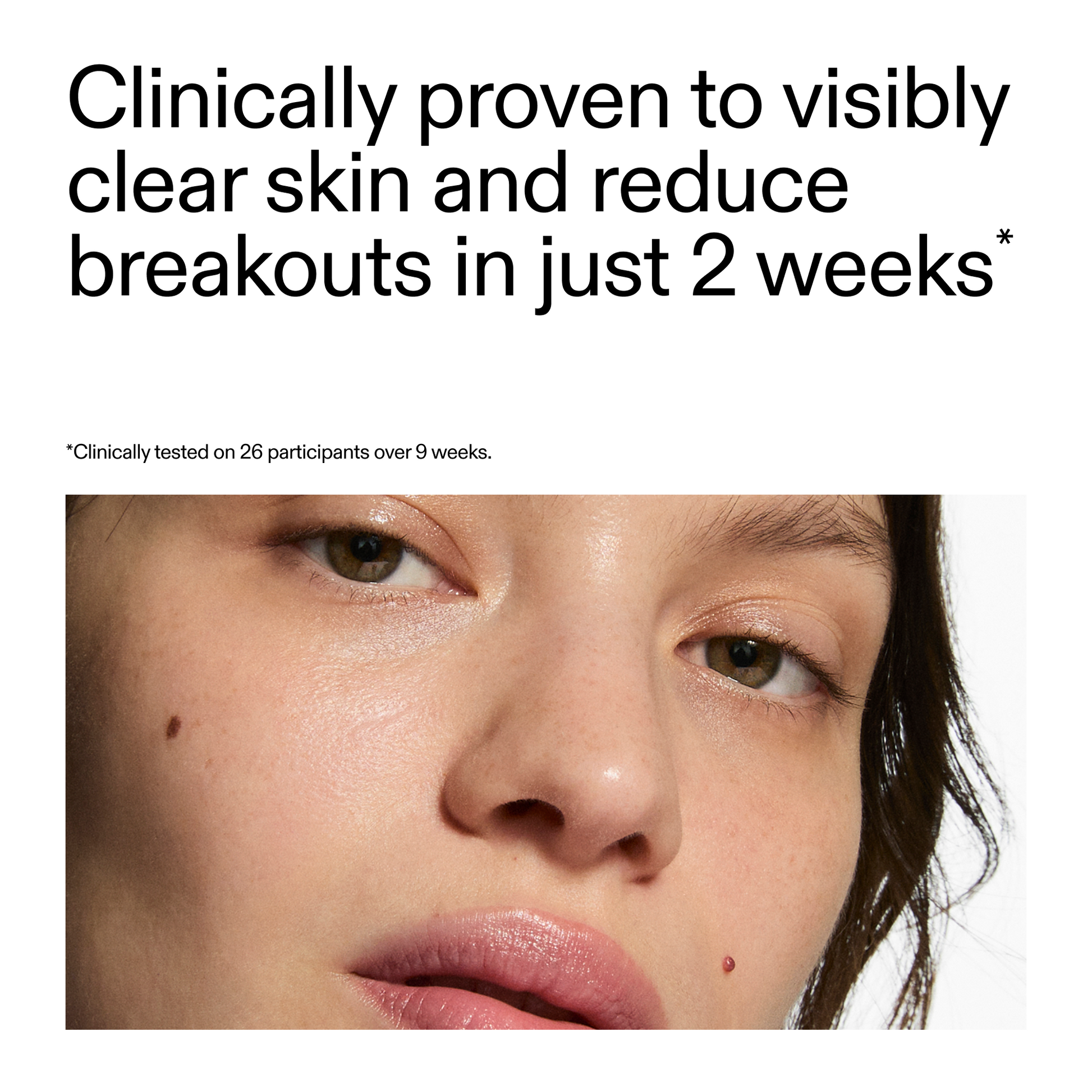360-acne-clearing-duo-f2 360_Serum_Key_Claim.png