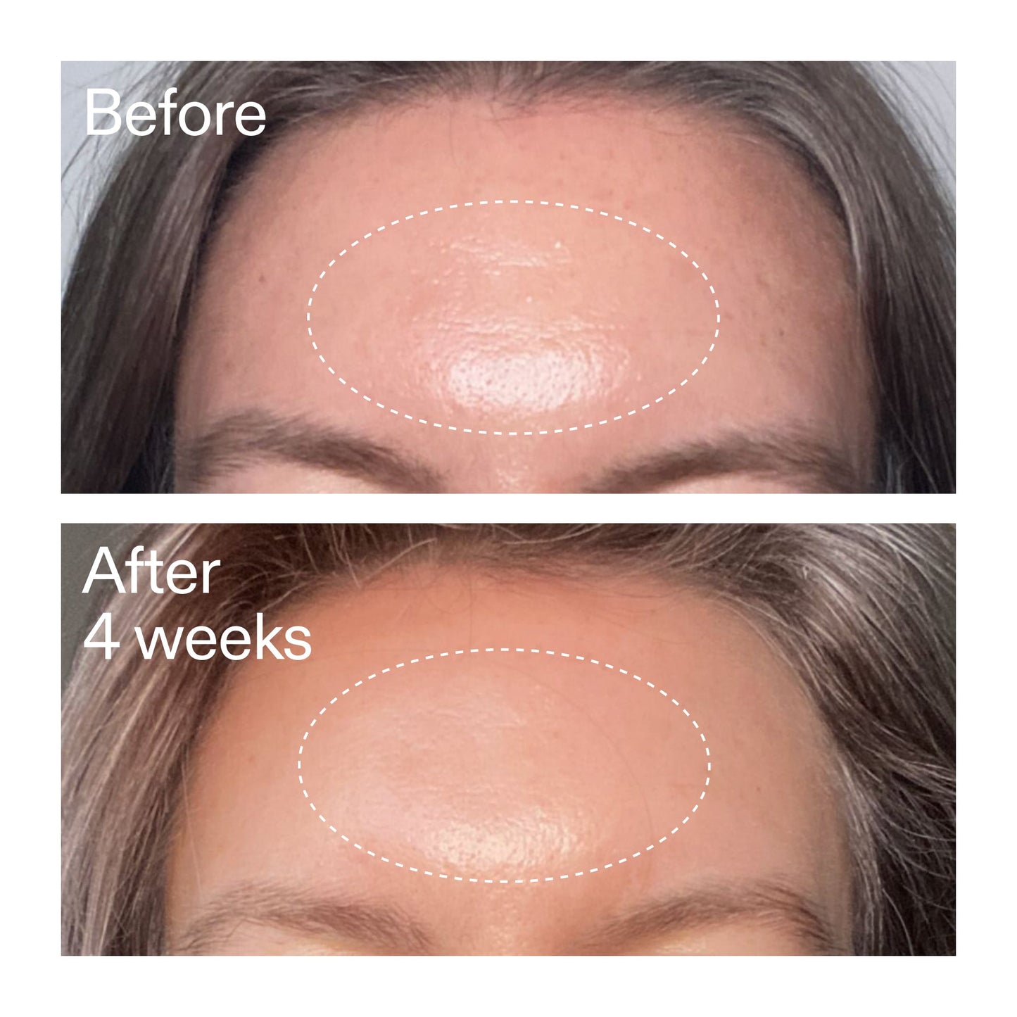 advanced-0-2-retinal-serum-n6 AdvancedRetinal_BeforeAfter1_2000x2000_1da6bb0a-29dd-41d1-95b7-8679696bbf0f.jpg