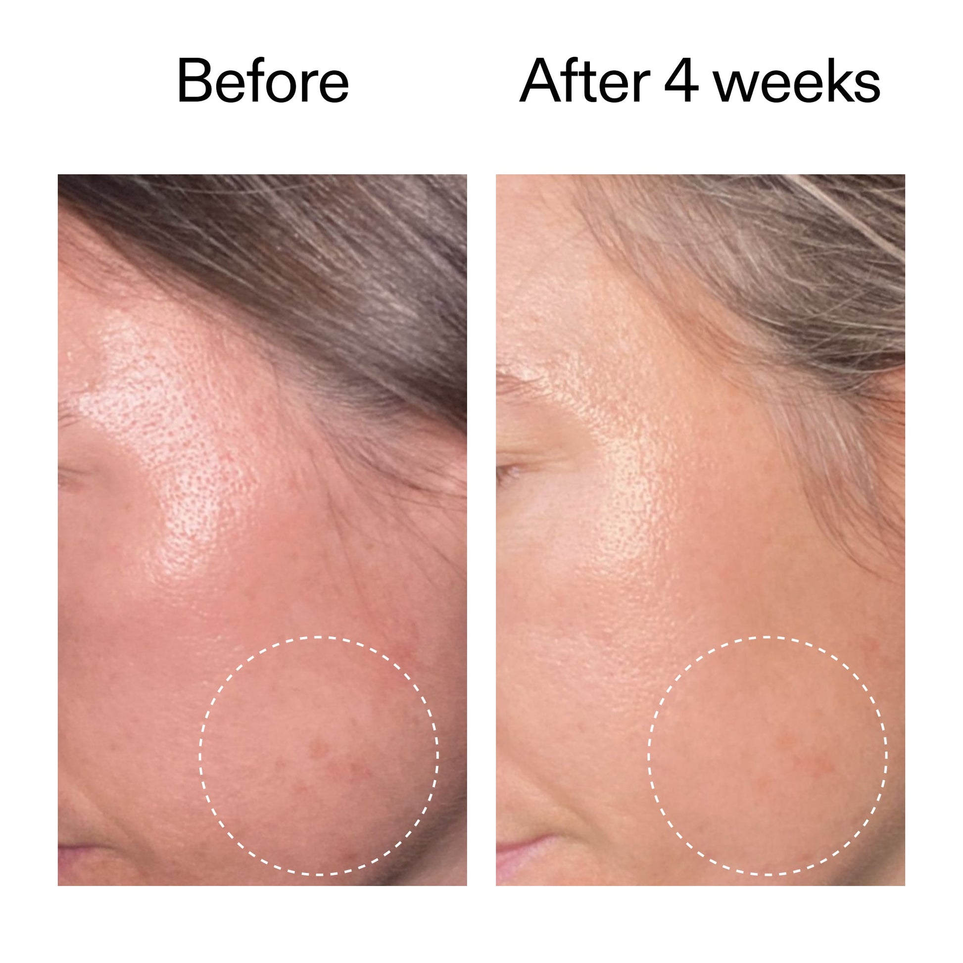 advanced-0-2-retinal-serum-n6 AdvancedRetinal_BeforeAfter2__2000x2000_62fb16bb-77ae-4d63-8500-88dbf847f4b9.jpg