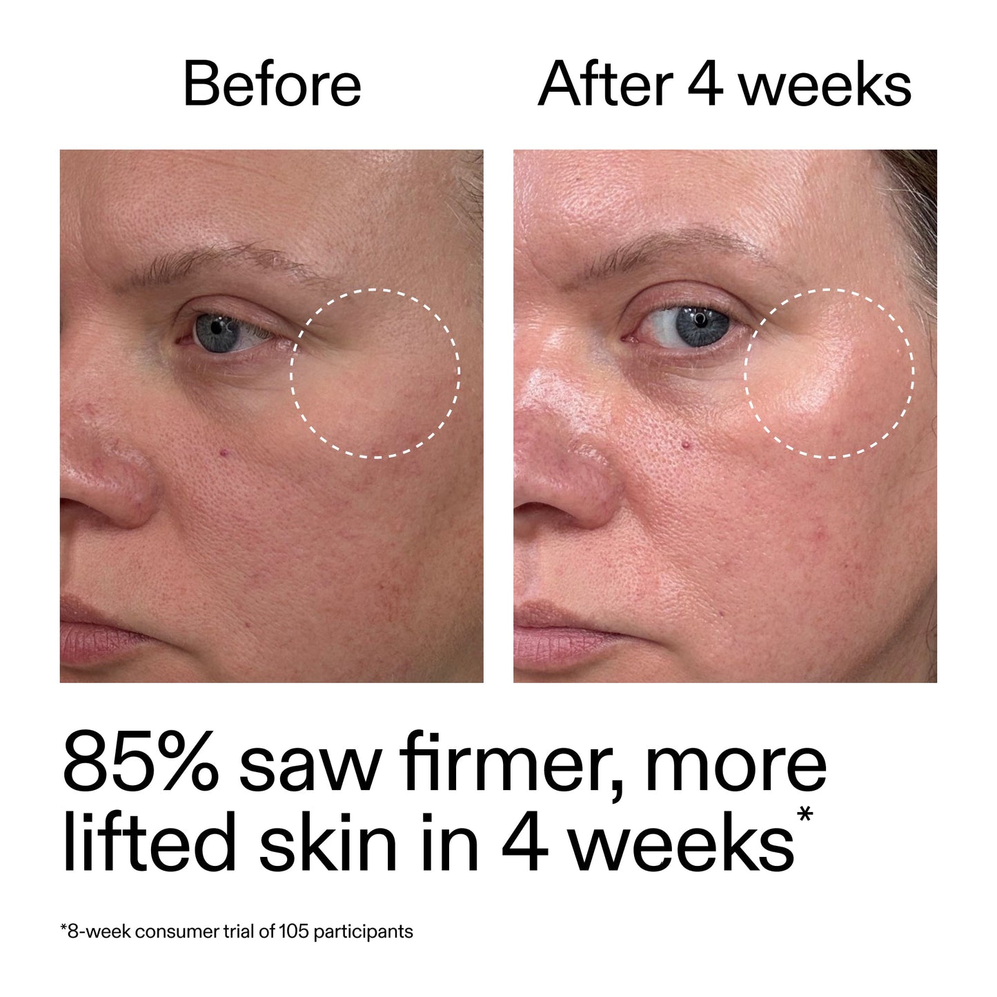 advanced-0-2-retinal-serum-n6 AdvancedRetinal_BeforeAfter_Claim1_2000x2000_bcc385c4-5e73-4f1e-aba8-64267937d0d3.jpg