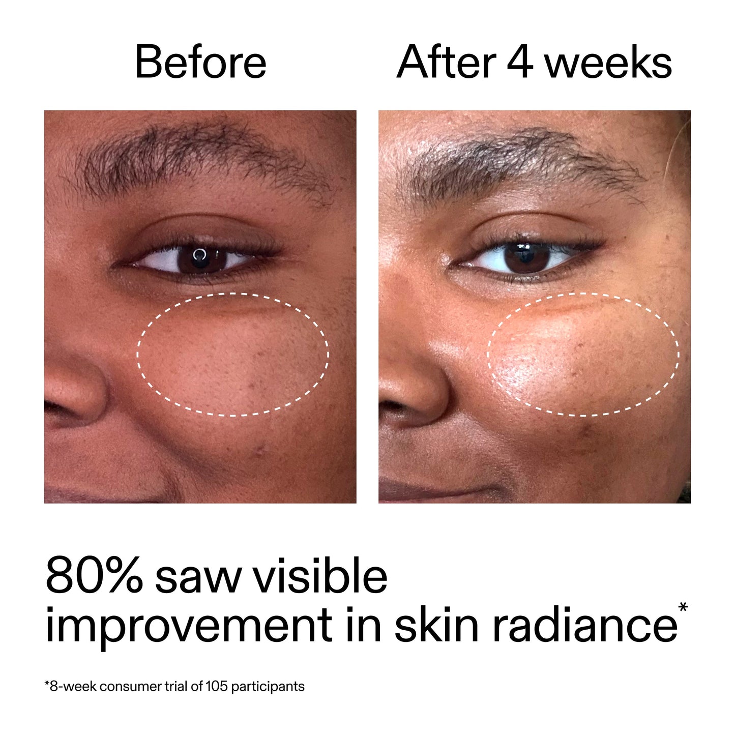 advanced-0-2-retinal-serum-n6 AdvancedRetinal_BeforeAfter_Claim2_2000x2000_39d11e3d-eda9-44ec-ab32-2903b1a368bd.jpg