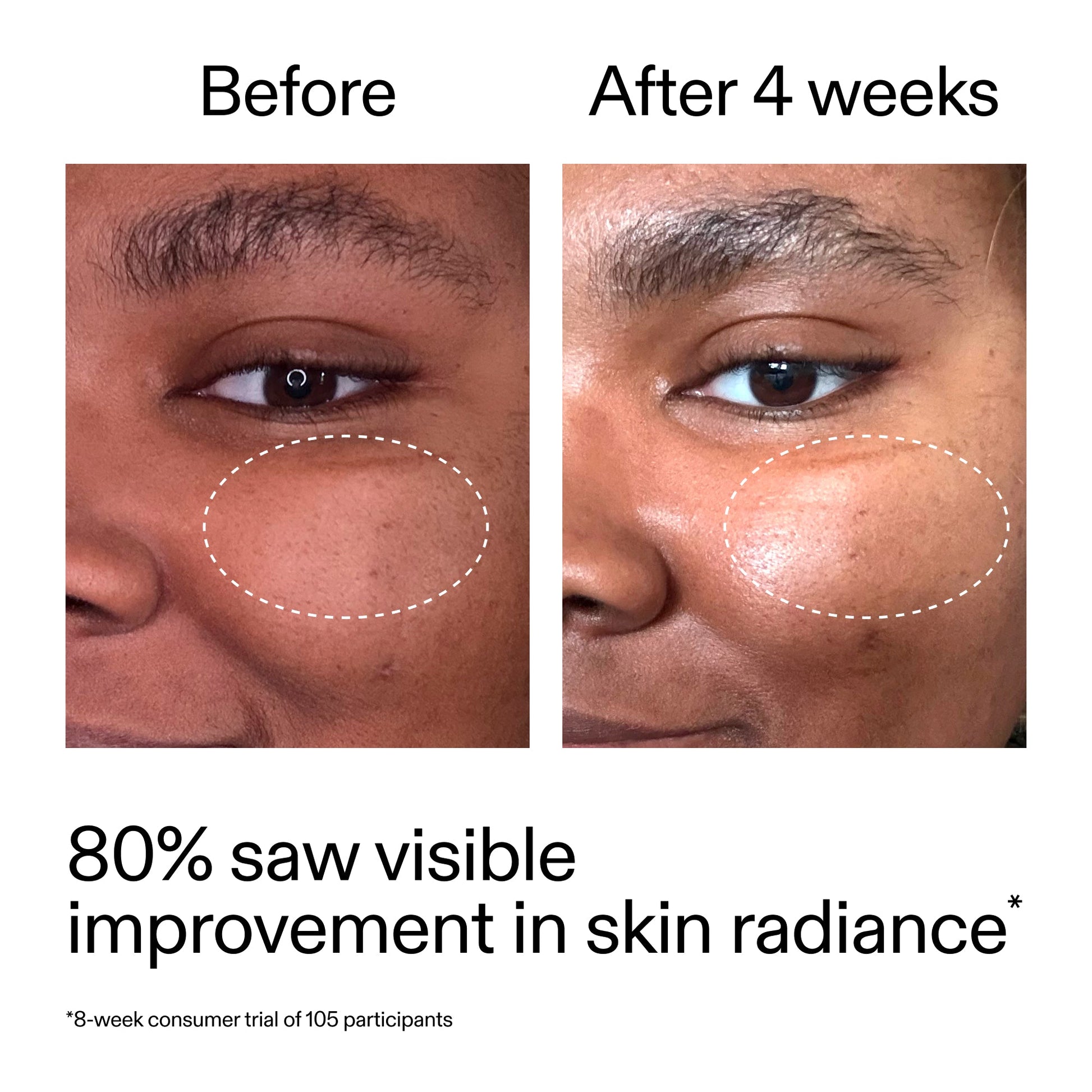 advanced-0-2-retinal-serum-duo-v4 AdvancedRetinal_BeforeAfter_Claim2_2000x2000_681b621d-8d44-4d44-9a40-89244f9b2e53.jpg