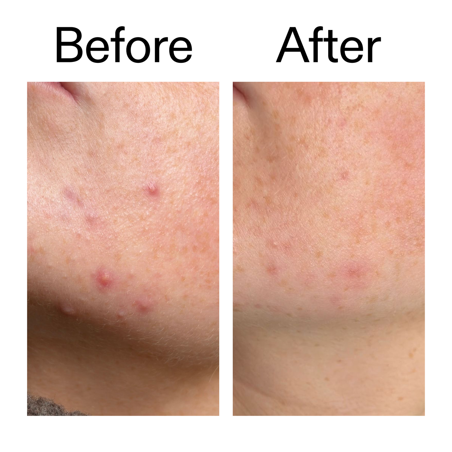 10-azelaic-acid-serum-for-redness-relief-e6 B_A_1_PPAGE.png