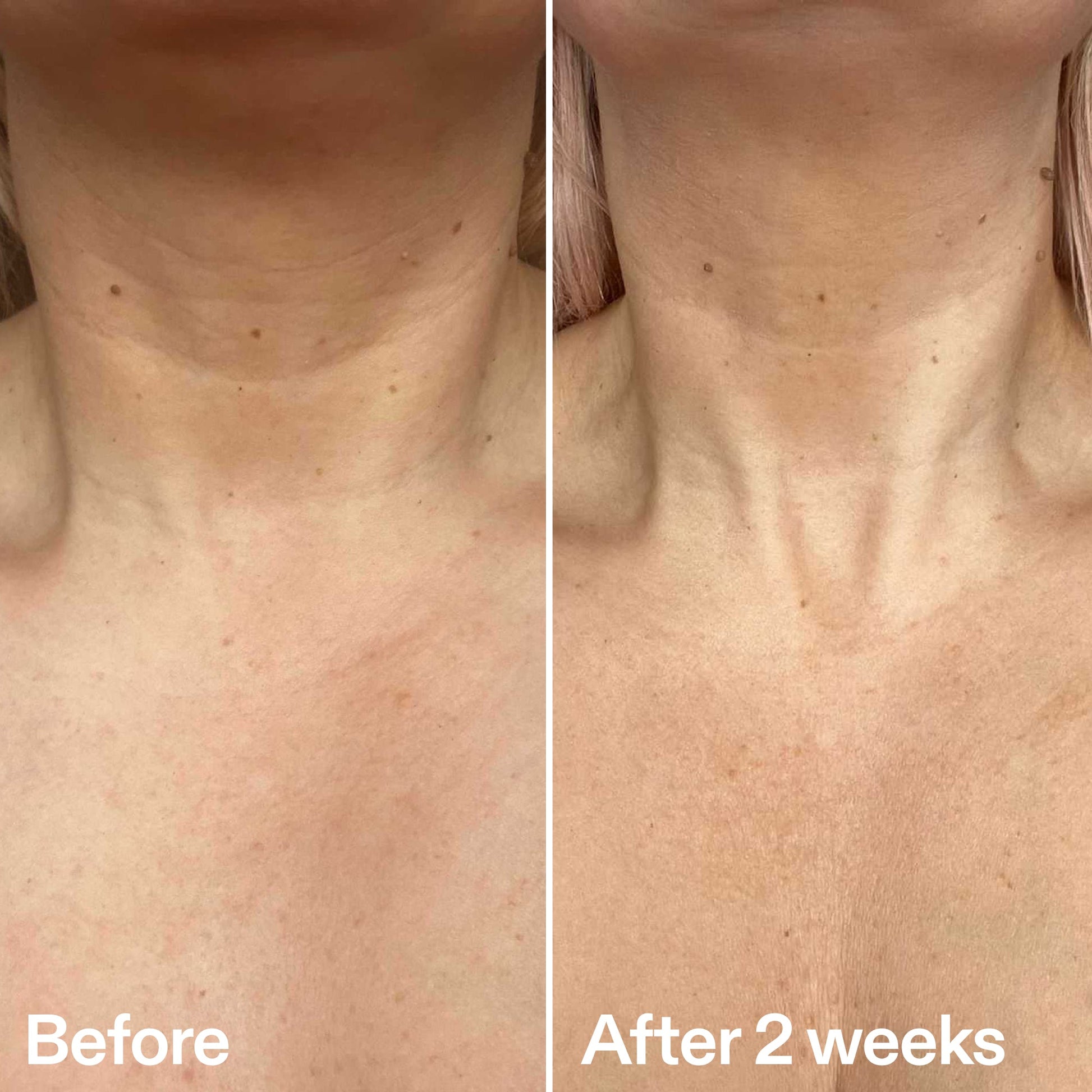 bio-active-neck-lift-stick-f6 B_A_2.jpg
