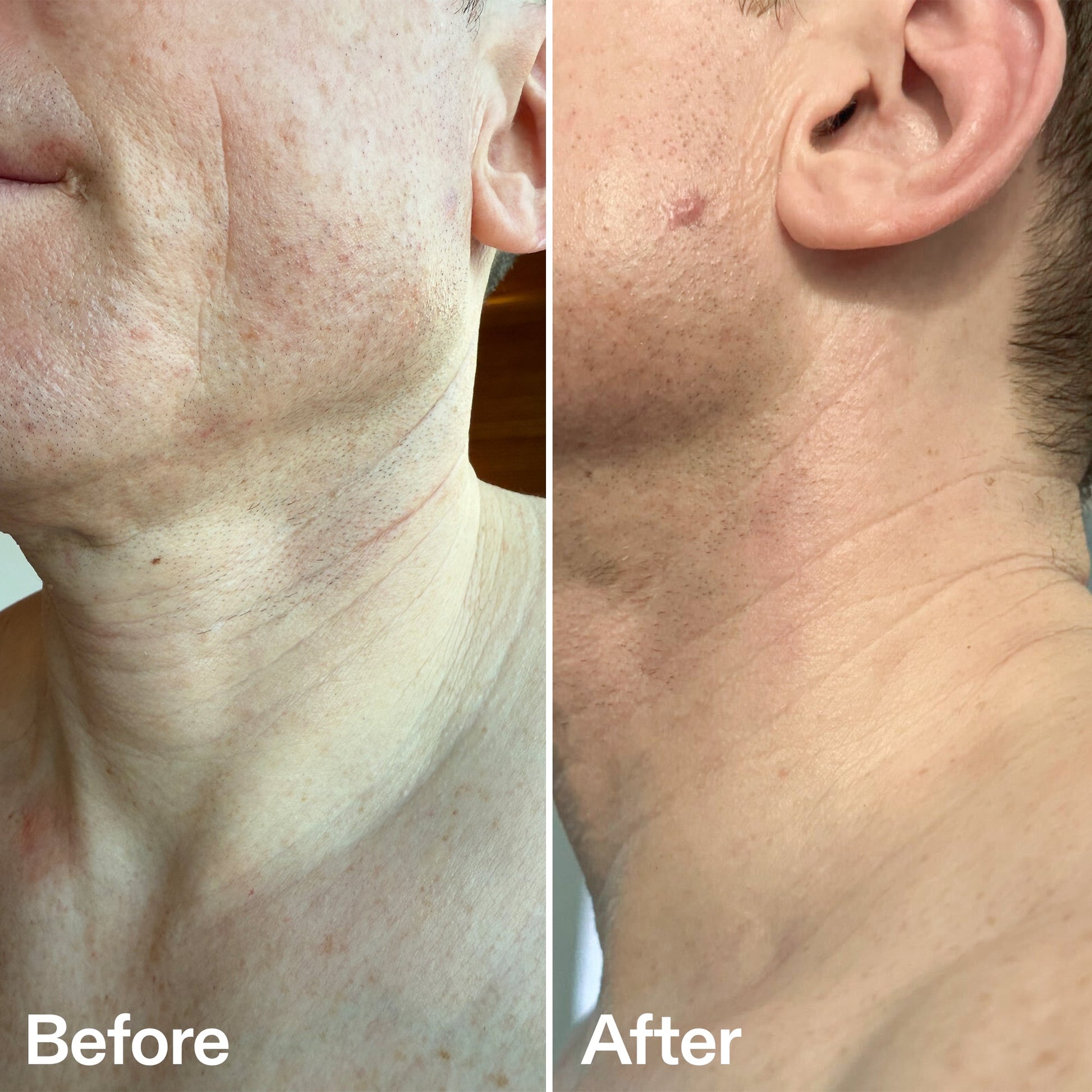 bio-active-neck-lift-stick-f6 B_A_afa2743e-b8e2-4504-92f4-e281cb6cf759.jpg
