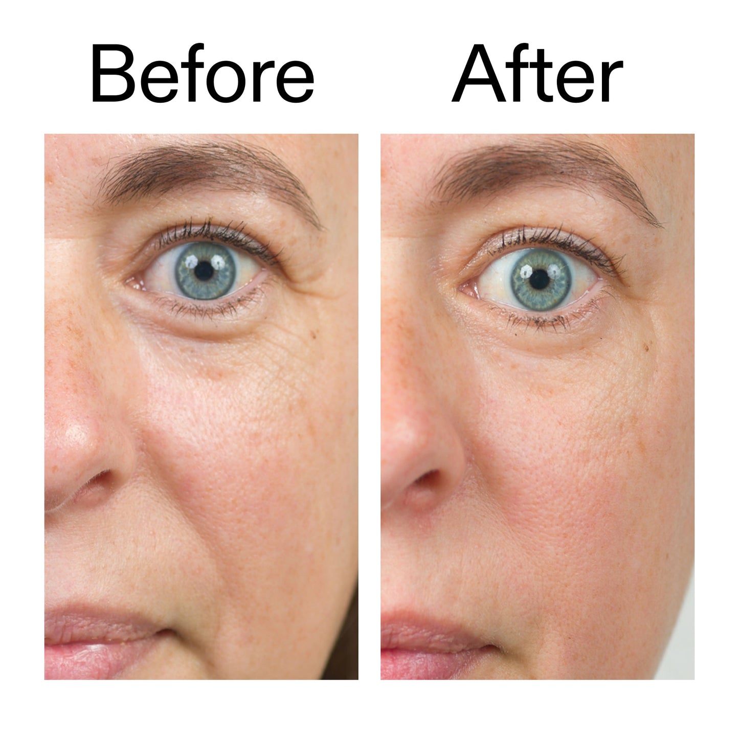 bio-active-ceramide-moisturizer-k7 Bio-Active_Before_After_2000x2000_566e5a9e-135e-417a-8242-b44e5fa35463.jpg