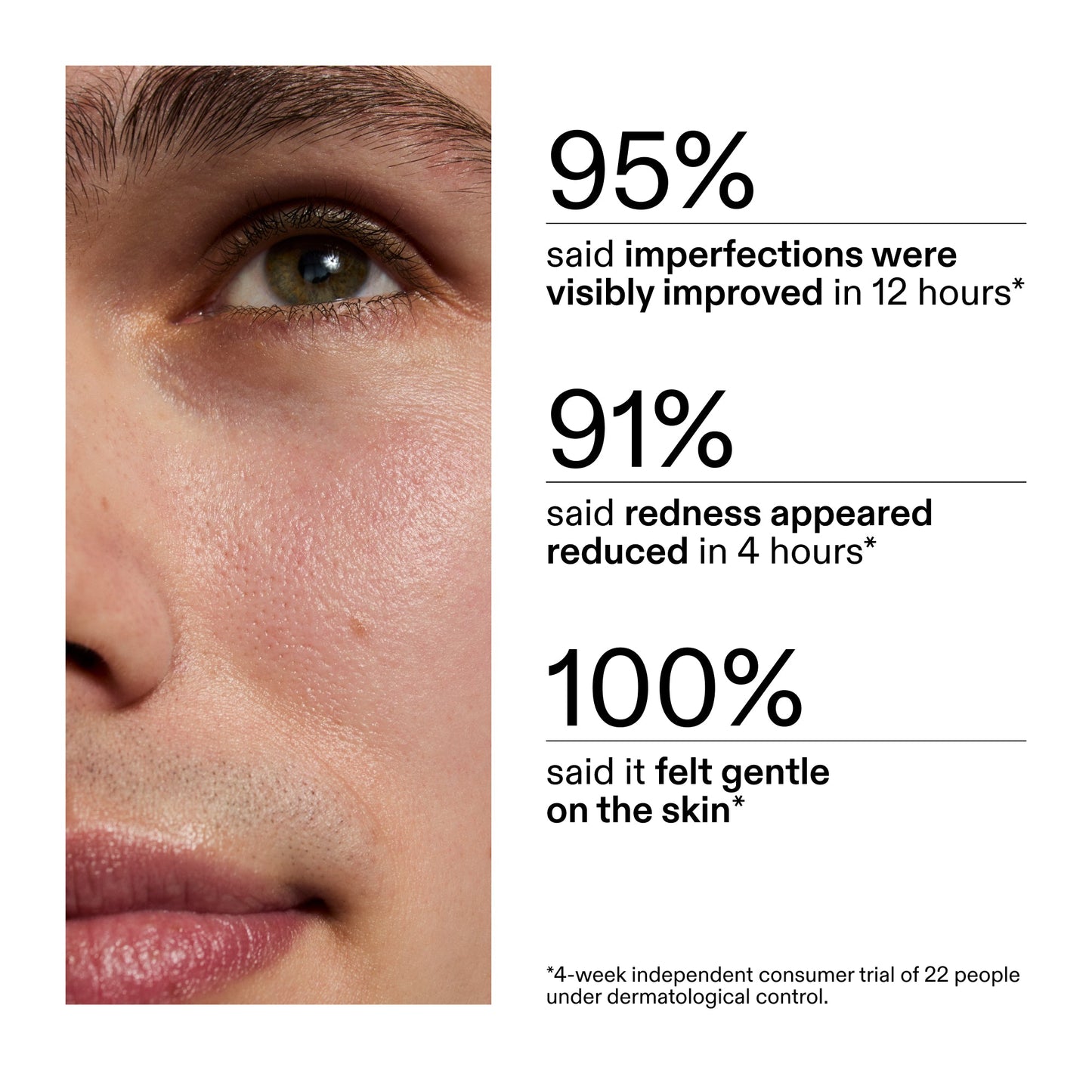 succinic-acid-acne-treatment-k3 CA_Succinic_Acid_Treatment_key_Claims_2000x2000_db91b0f1-7f29-4bfe-bb16-63a47f500960.jpg