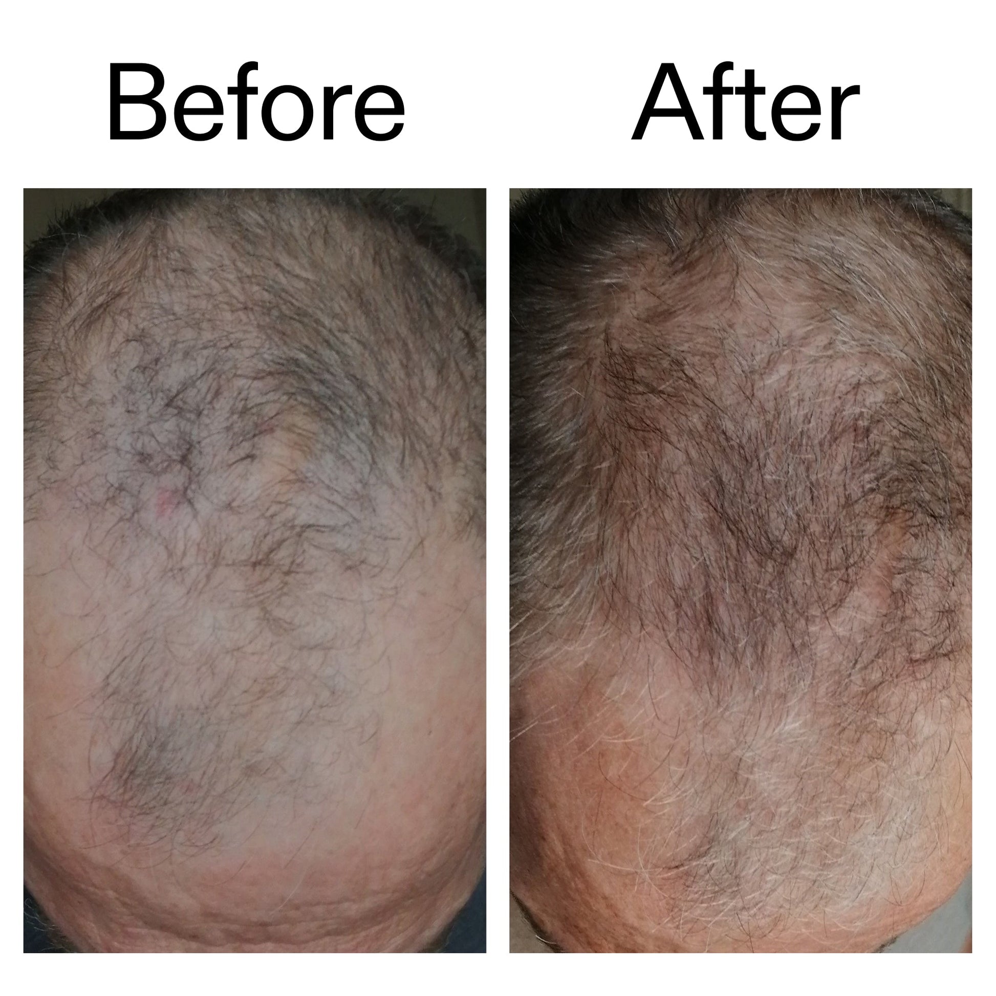 3-month-hair-growth-trio-z6 Caffeine_Scalp_Treatment_B_A_Ppage_2000_x_2000.jpg