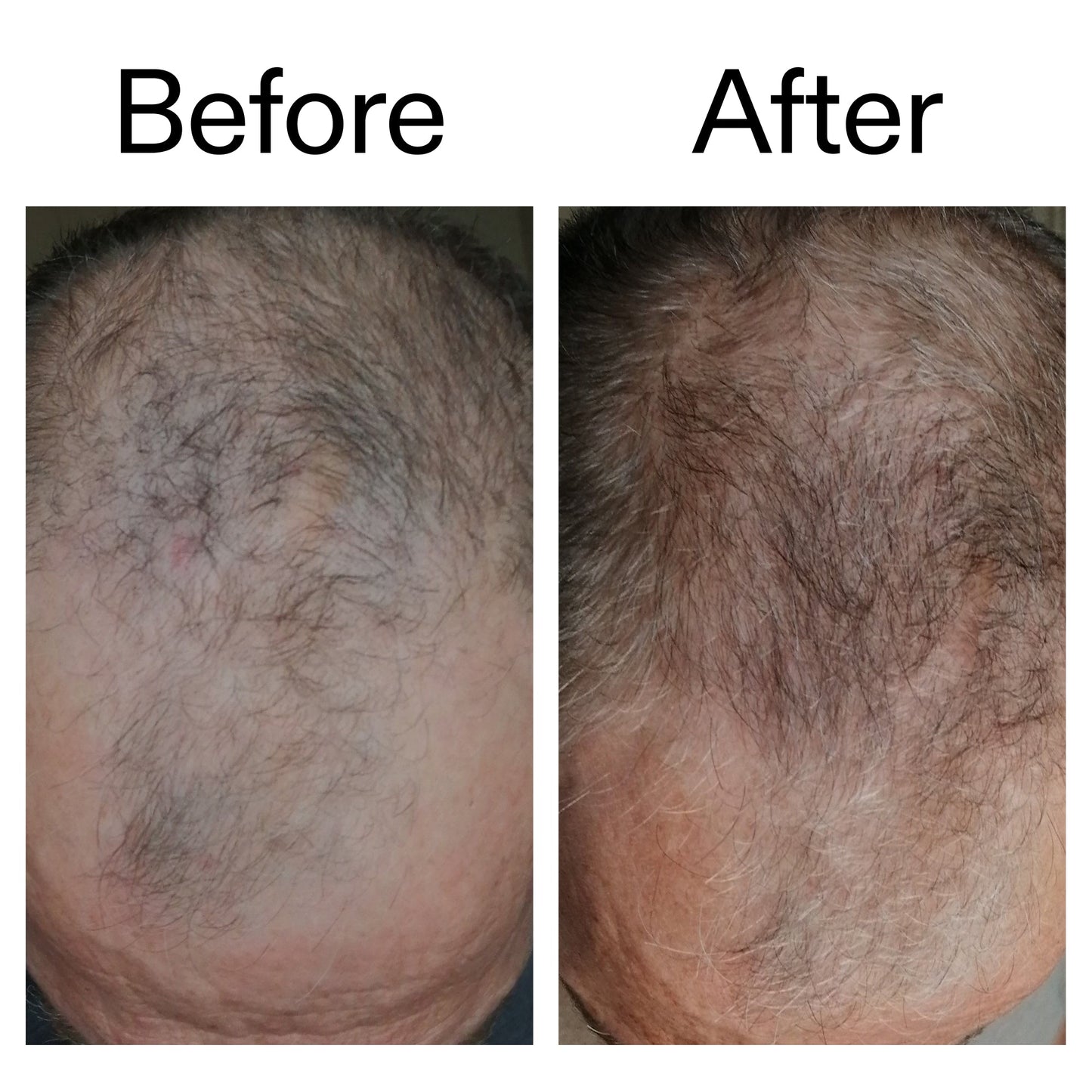 caffeine-stimulating-scalp-treatment-u7 Caffeine_Scalp_Treatment_B_A_Ppage_2000_x_2000.jpg