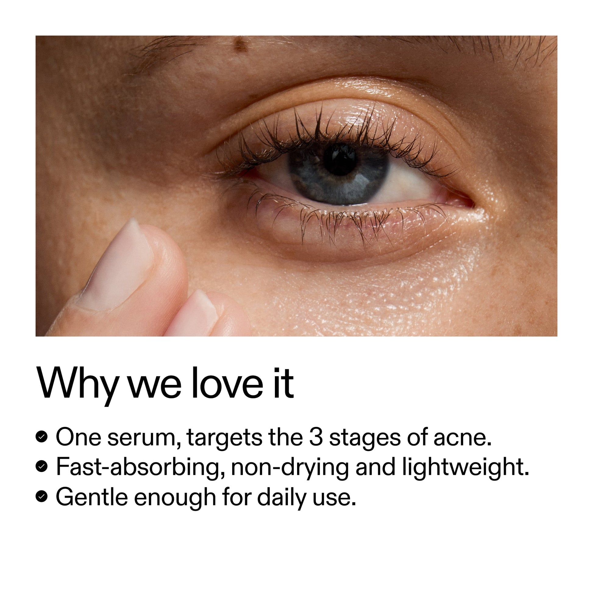 360-acne-clearing-serum-d9 Dioic_Whyweloveit_2000x2000_175aafd3-0cbe-403a-b317-a8362881bfe2.jpg