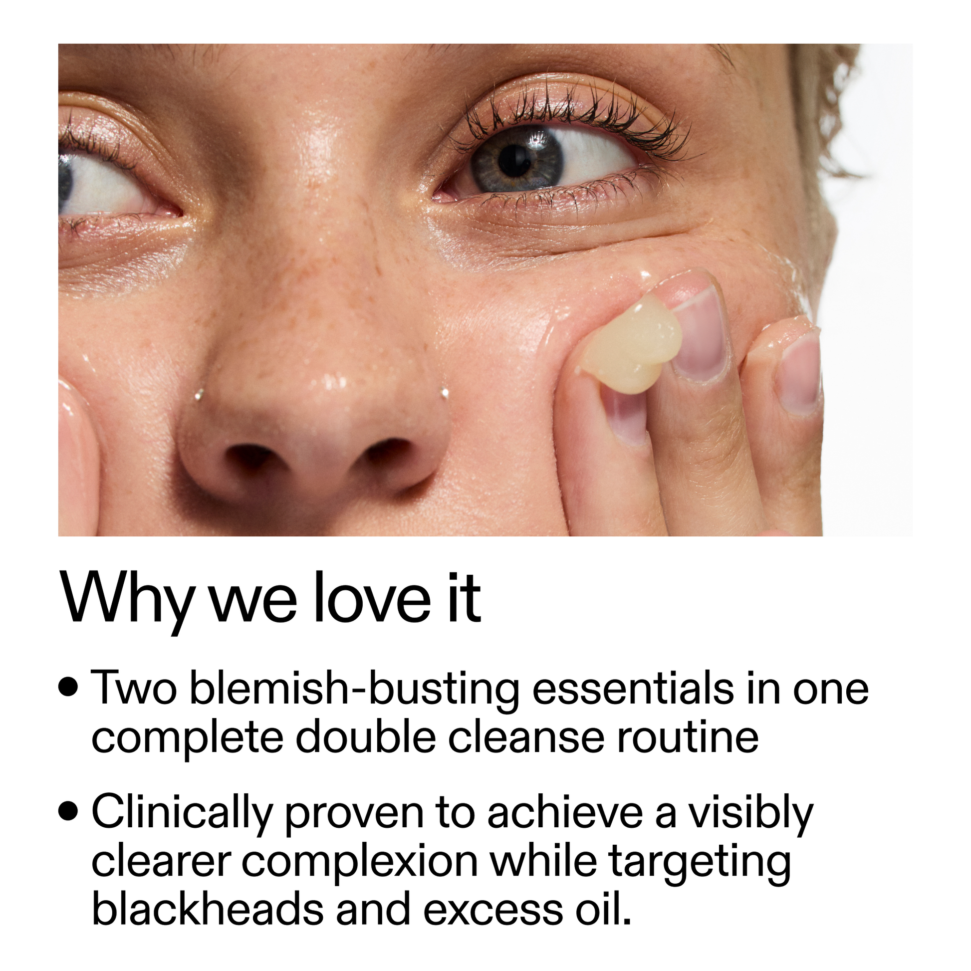 acne-double-cleanse-duo-w5 Double_Cleanse_Duo_for_Breakouts_Why_We_2000x2000_f242cb12-bb5c-487c-b203-071ccb406ec5.png