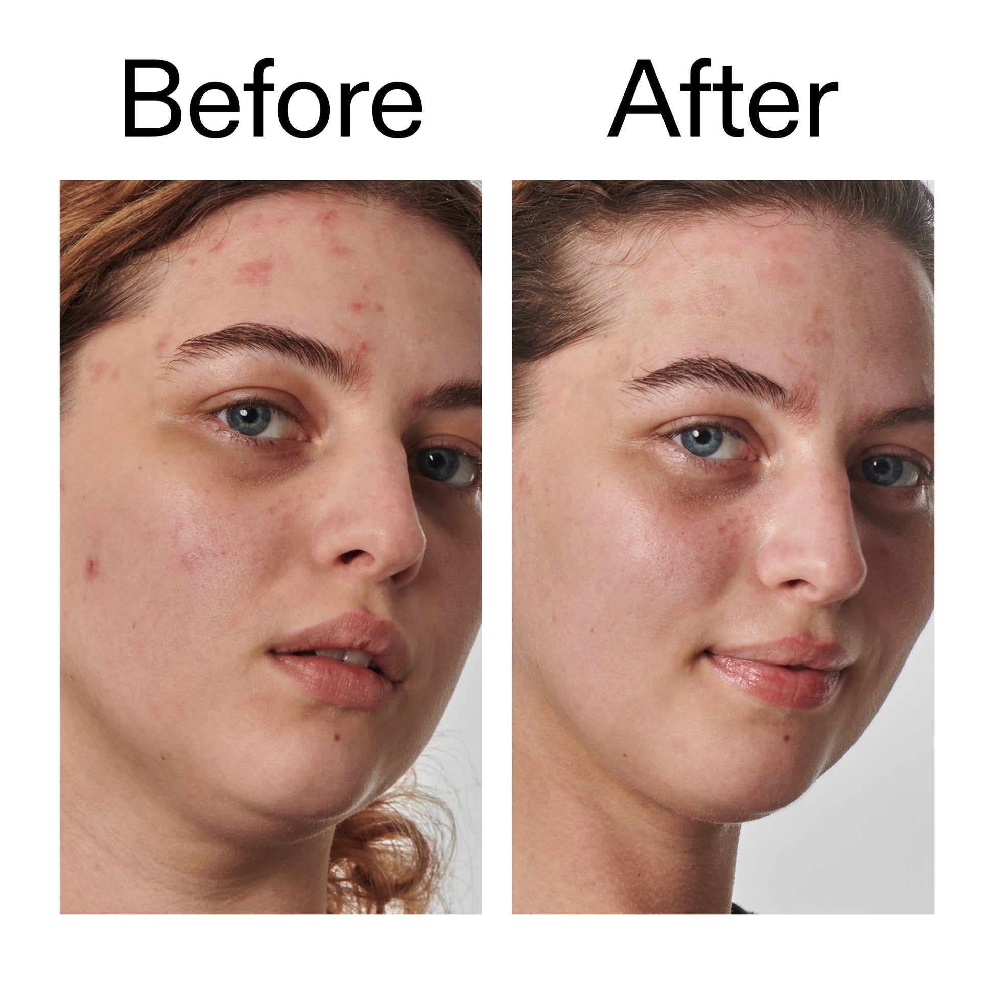 10-urea-moisturizer-m8 Dry_and_Rough_Skin_Solution_Before_After_2000x2000_efa6e639-5c39-49bd-a5dd-f0220293120a.jpg