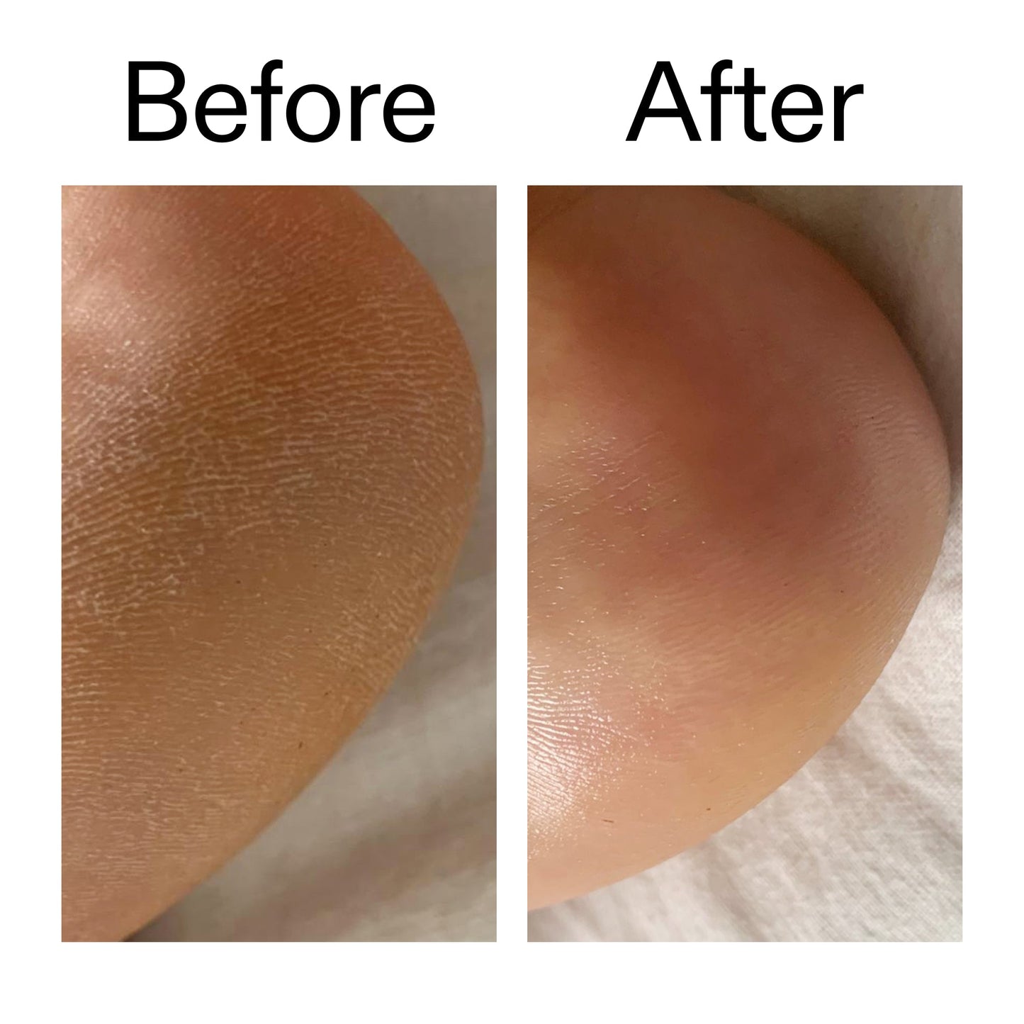 glycolic-acid-exfoliating-body-stick-duo-q8 Glycolic_Acid_Exfoliating_Body_Stick_Before_After_V1_2000x2000_a3043625-9400-429a-a7fb-d6dbd220f722.jpg