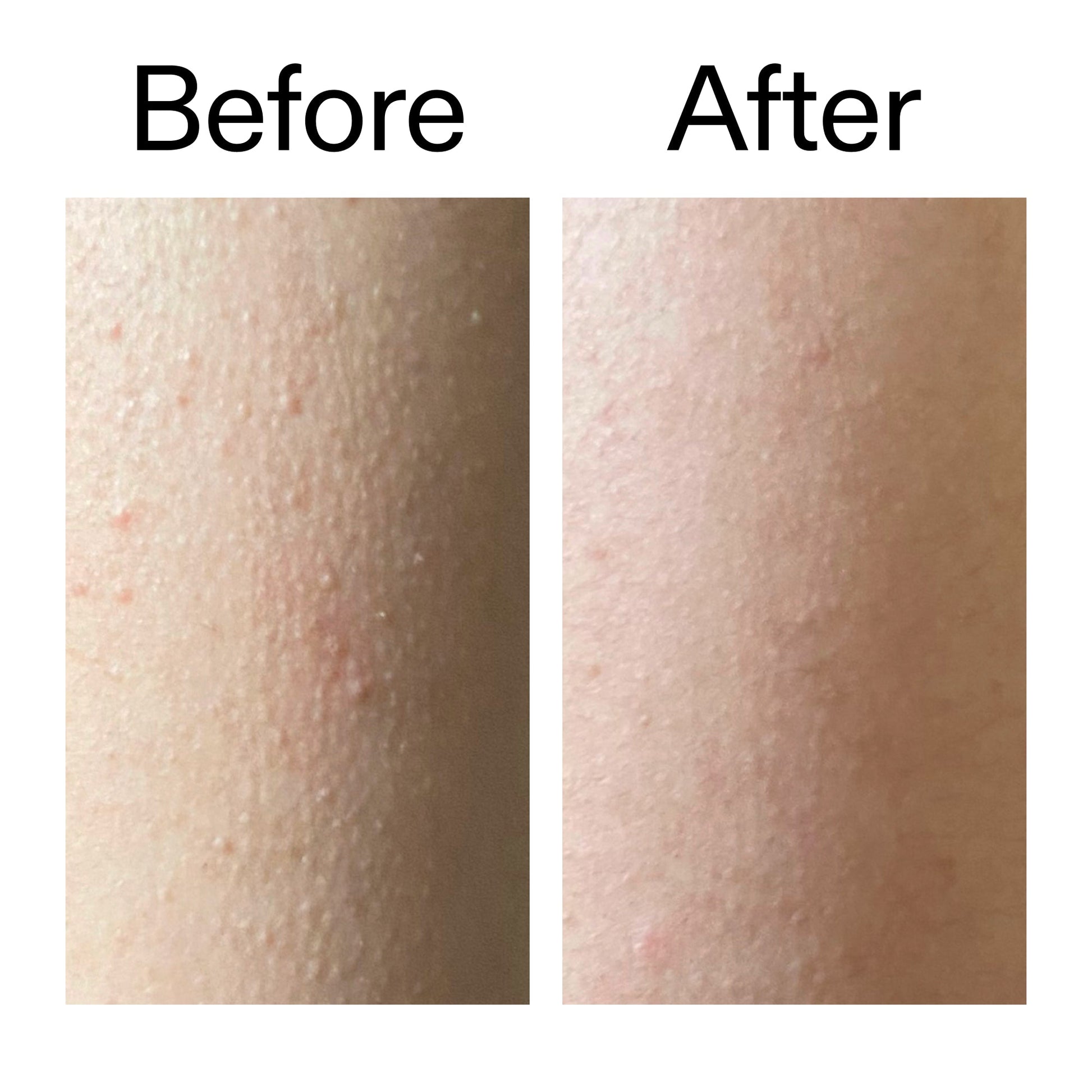 glycolic-acid-exfoliating-body-stick-d1 Glycolic_Acid_Exfoliating_Body_Stick_Before_After_V2_2000x2000_2e4ba052-94f6-4d56-82df-7bdb5b2df7ae.jpg