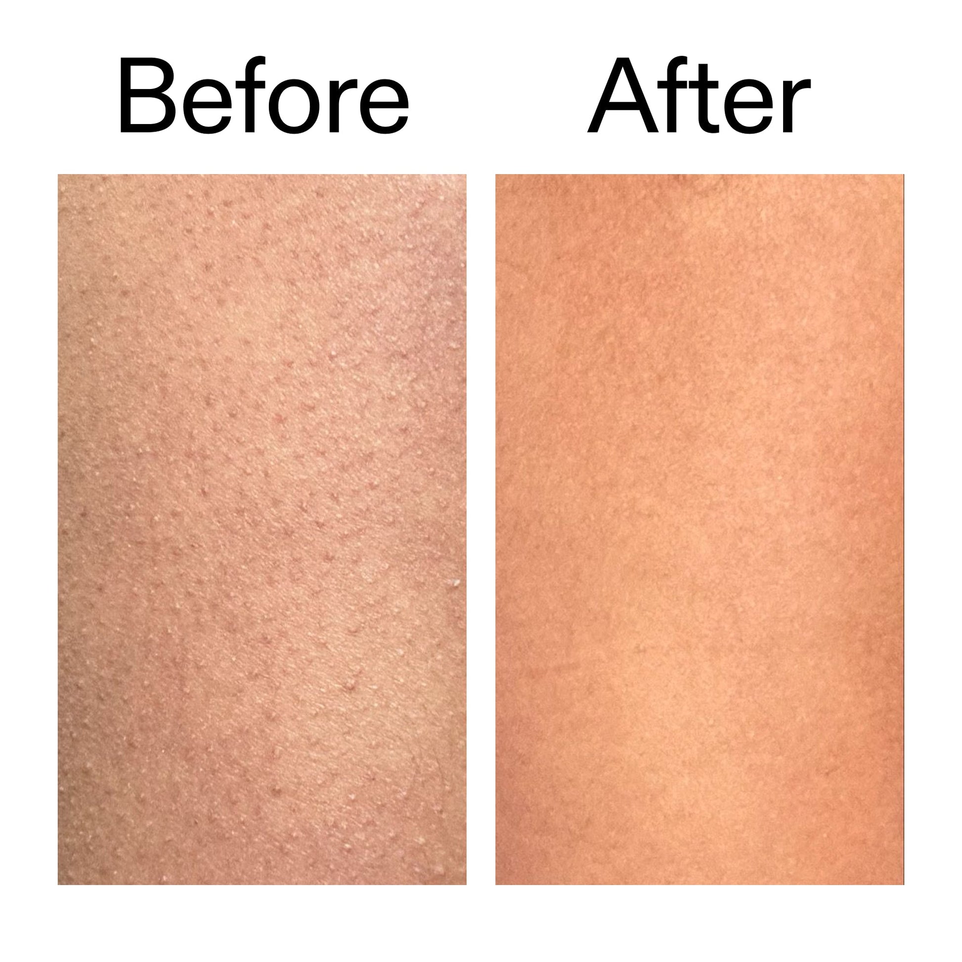 glycolic-acid-exfoliating-body-stick-duo-q8 Glycolic_Body_Stick_B_A_2000x2000_6e6e6b4d-5bd7-43c0-aeed-4d66788e8995.jpg