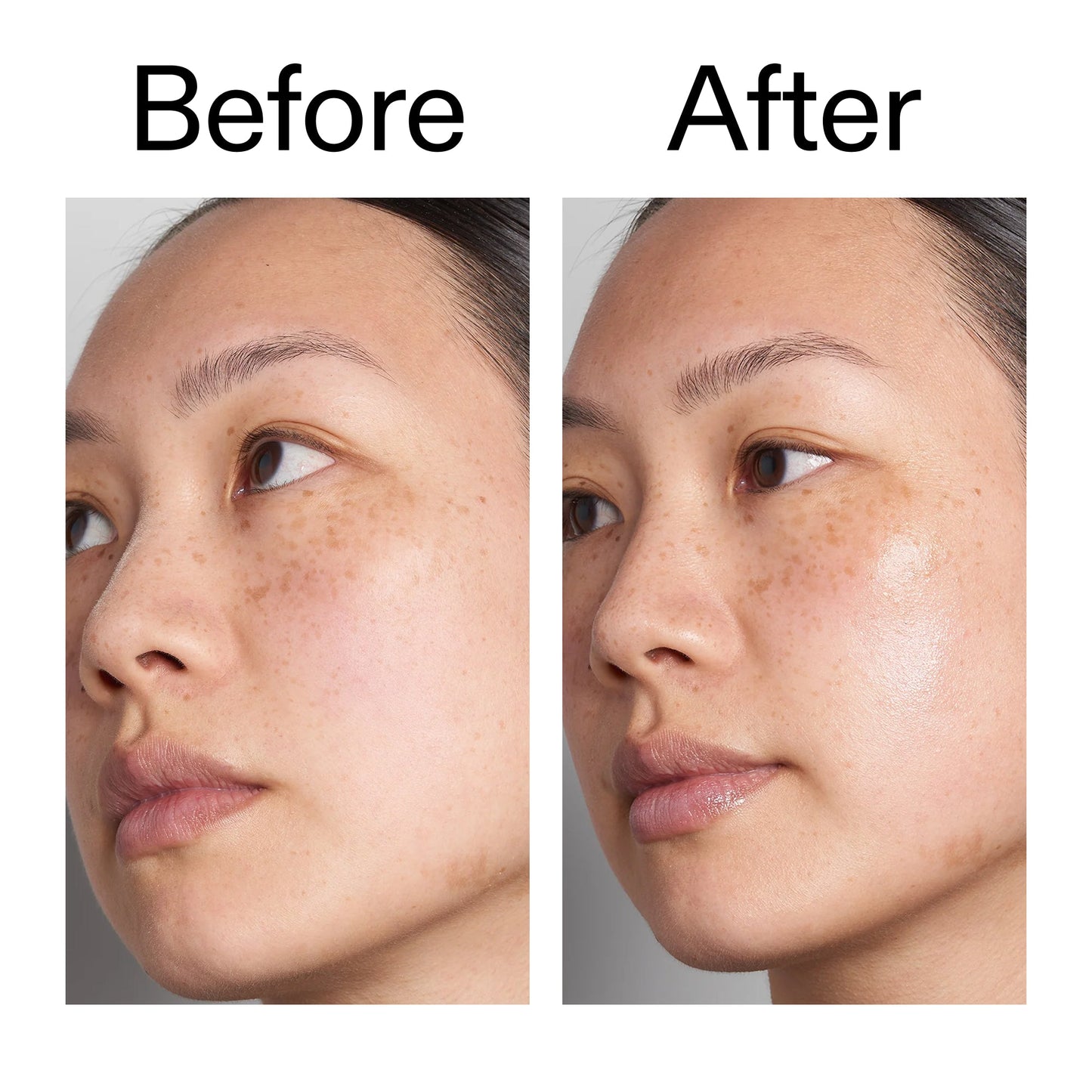 supersize-hyaluronic-acid-serum-100ml-j9 Hyaluronic_Acid_Before_After_2000x2000_d7983956-8aa2-4ea3-8255-c63e8d4f892e.jpg