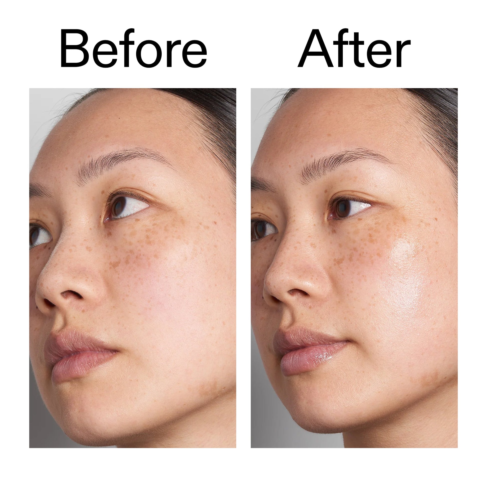supersize-hyaluronic-acid-serum-100ml-duo-e0 Hyaluronic_Acid_Before_After_2000x2000_d7983956-8aa2-4ea3-8255-c63e8d4f892e.jpg
