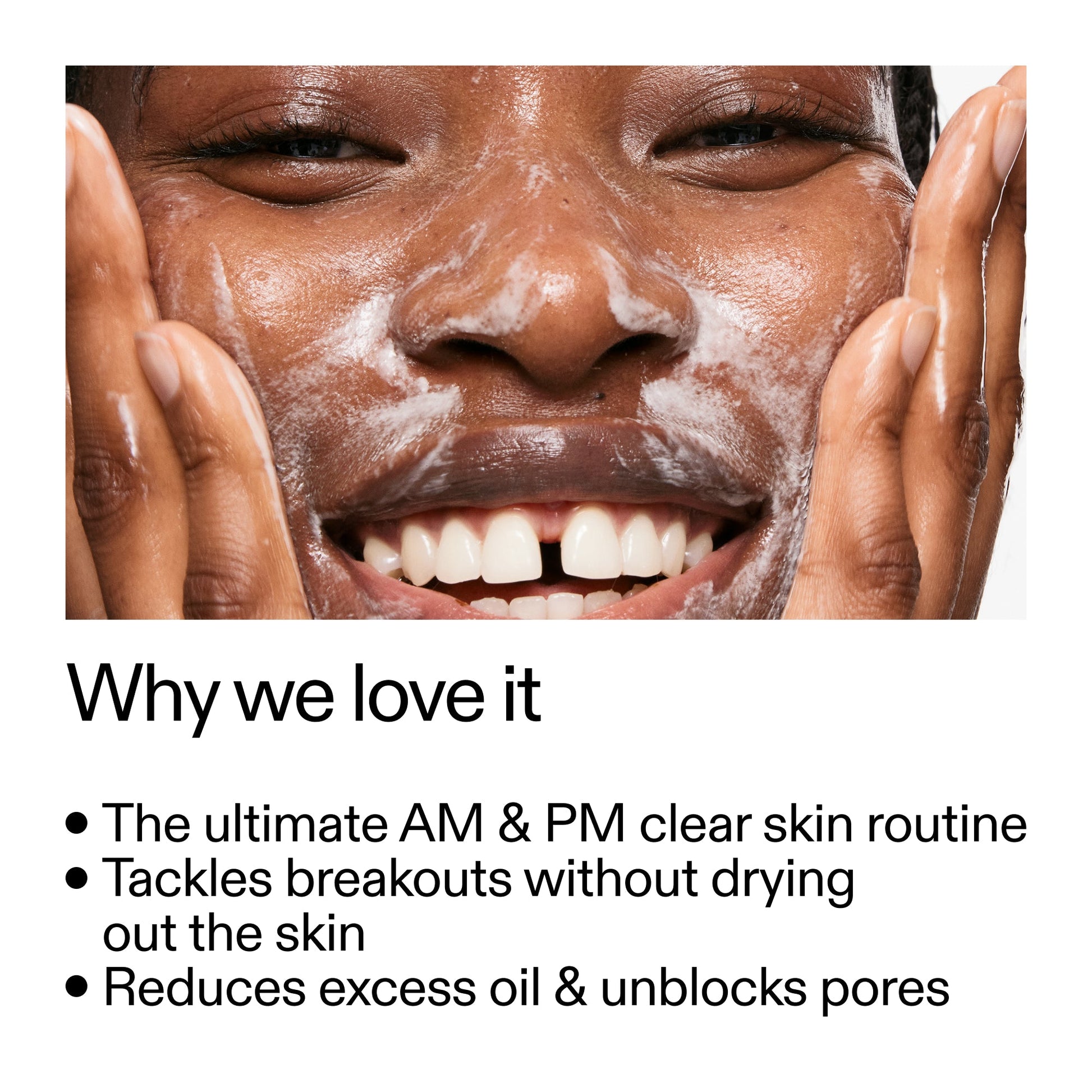 intro-routine-for-acne-q2 Intro_Routine_for_Acne_Why_we_love_it_2000x2000_42499e10-4629-4a0e-a627-7e215f4da6bc.jpg