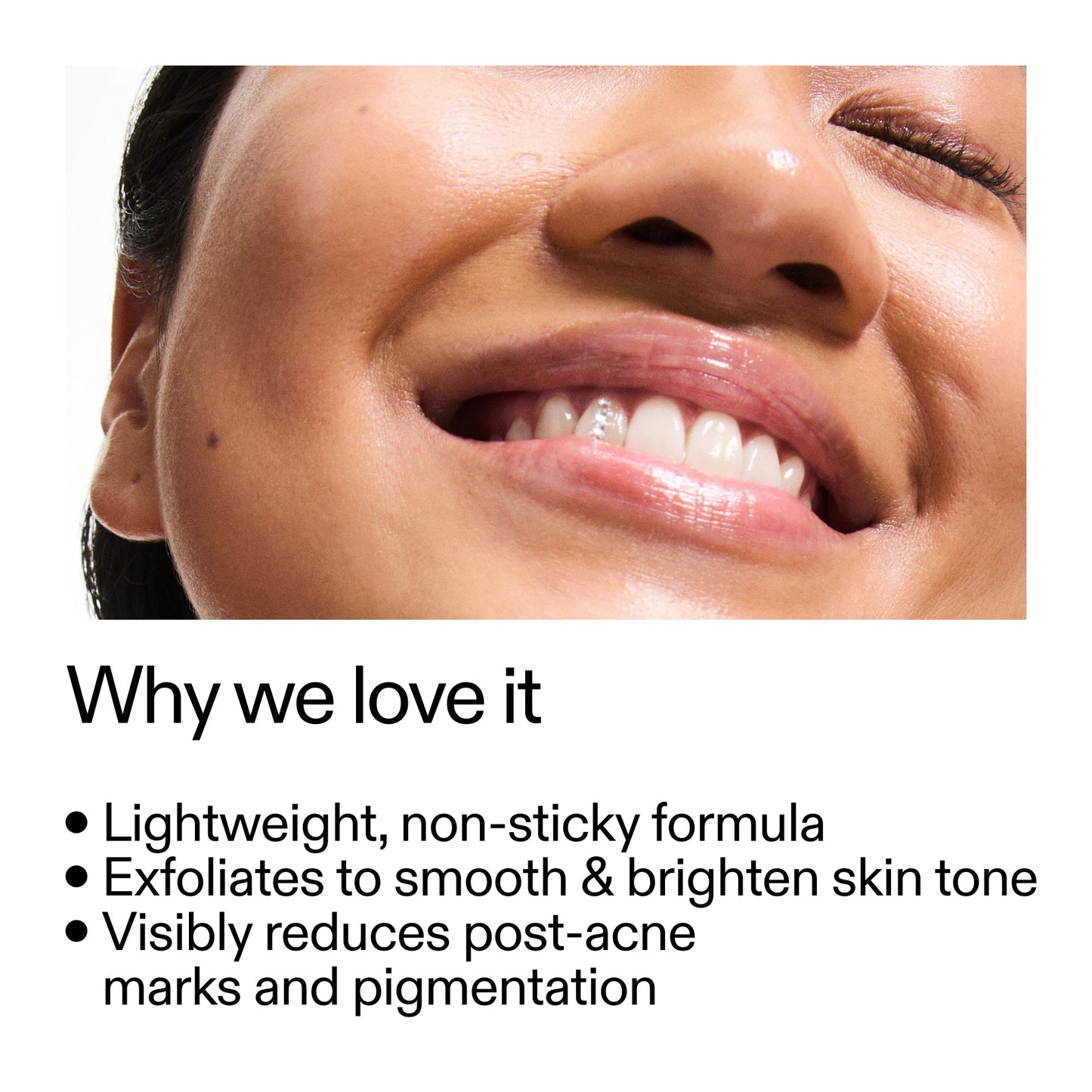 mandelic-acid-treatment-h9 Mandelic_Acid_Treatment_Why_we_love_it_2000x2000_6dfe29a9-2a79-464f-a5e8-e5ac37d93388.jpg