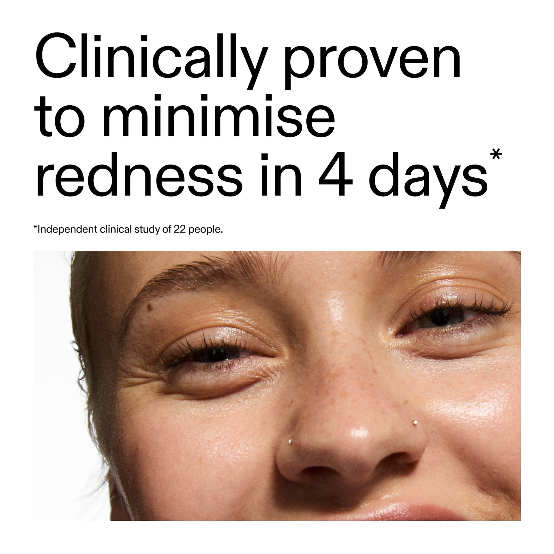 10-azelaic-acid-serum-for-redness-relief-e6 Oat_Cleansing_Balm_Claim_2000x2000_52a841dc-353c-4f2c-8646-3aadb604507d.jpg