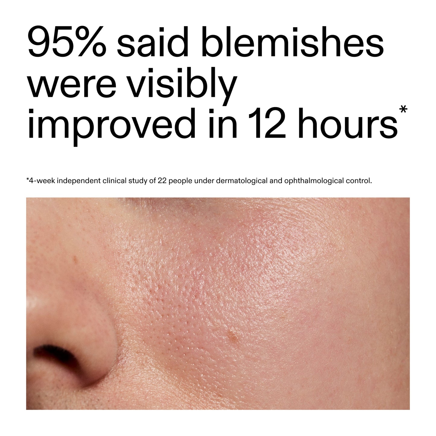 succinic-acid-acne-treatment-k3 Oat_Cleansing_Balm_Claim_2000x2000_ac6ce553-25db-41b2-a981-faae1ac4b8c0.jpg