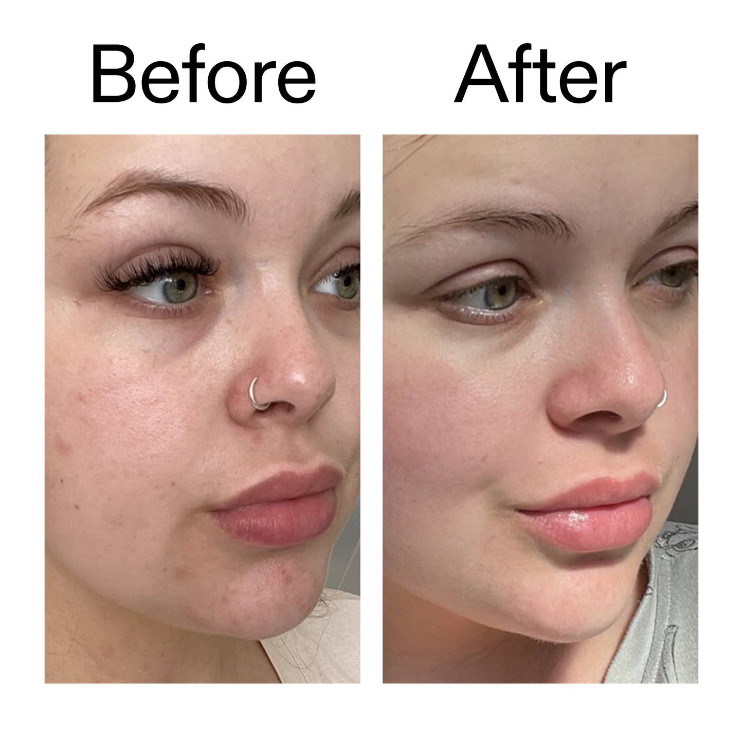 supersize-omega-water-cream-duo-n7 Omega50_Before_After_2000x2000_46483ed8-3f9d-487f-9a0c-9df79830bd65.jpg