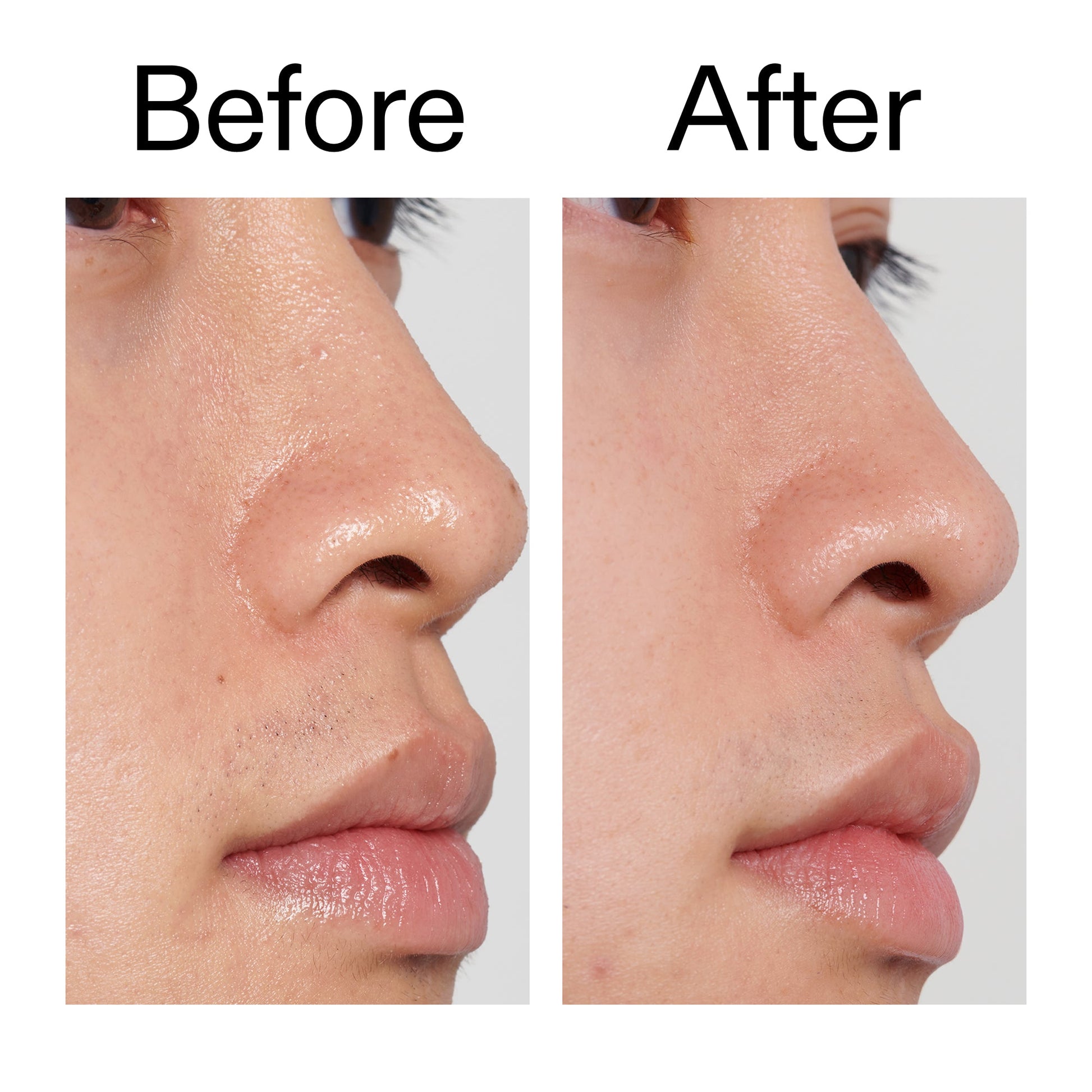 pha-toner-e8 PHA_Toner_Before_After_2000x2000_e3c10172-0150-4342-8b95-57417eaff50d.jpg
