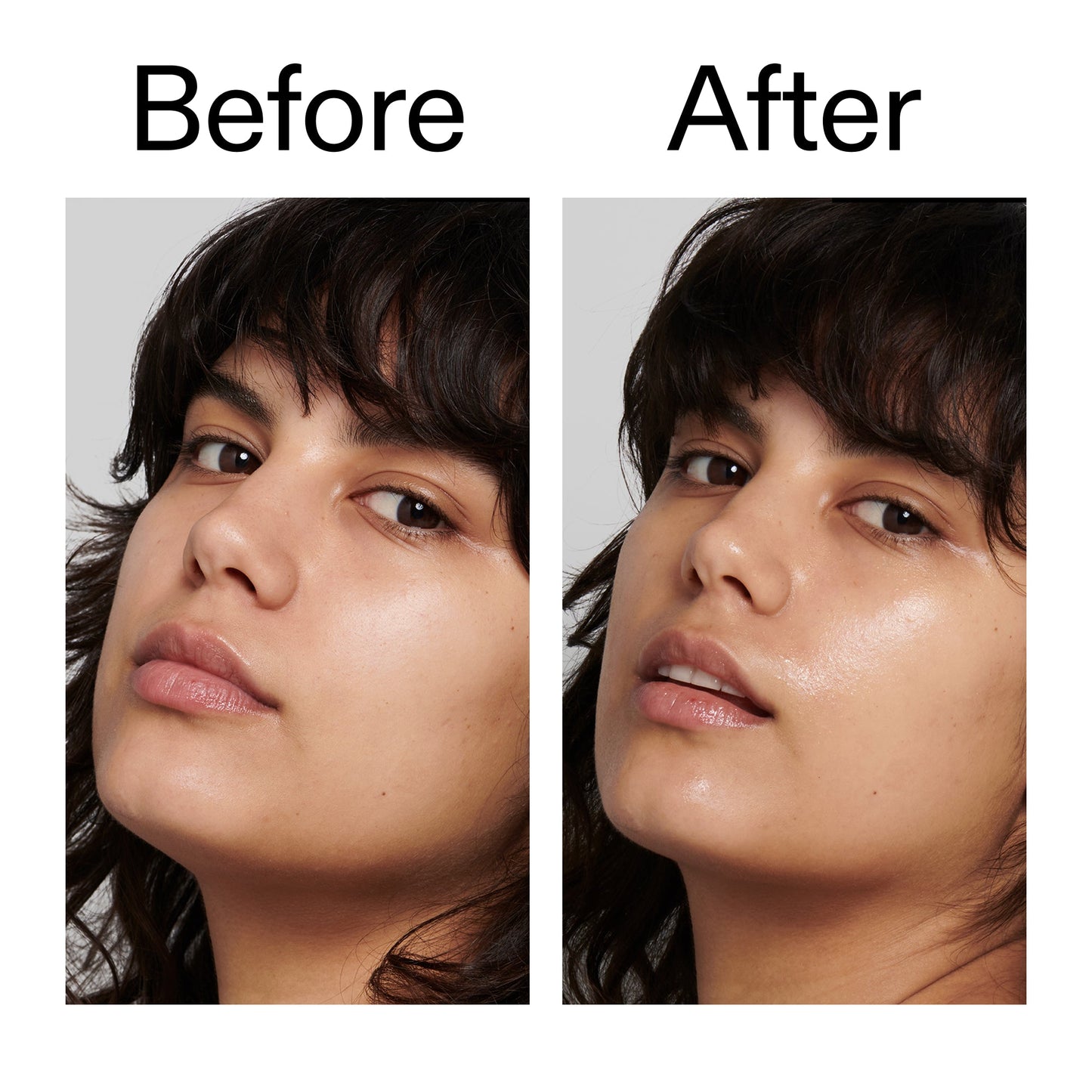 polyglutamic-acid-serum-q5 Polyglutamic_Acid_Serum_Before_After_2000x2000_dc0e1f71-d72b-4358-9c3a-ae43ead715d6.jpg