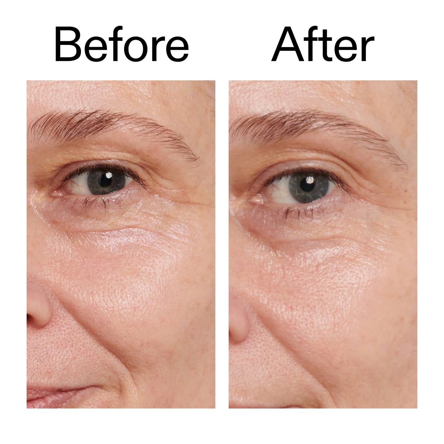 retinol-eye-cream-v9 Retinol_Eye_Cream_Before_After_2000x2000_ac03a80c-109e-4572-a95a-91dc109b4d27.jpg
