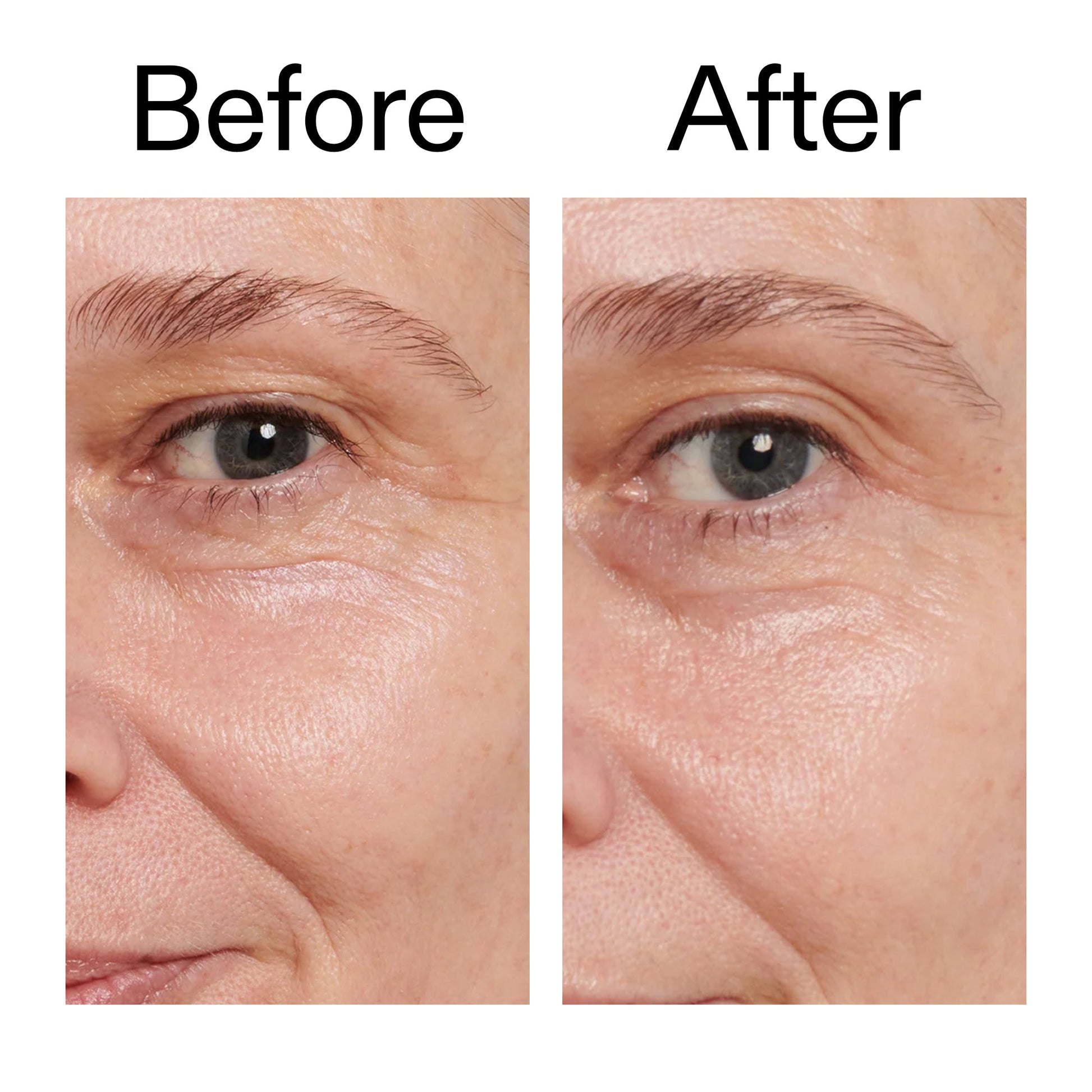 retinol-eye-cream-v9 Retinol_Eye_Cream_Before_After_2000x2000_ac03a80c-109e-4572-a95a-91dc109b4d27.jpg