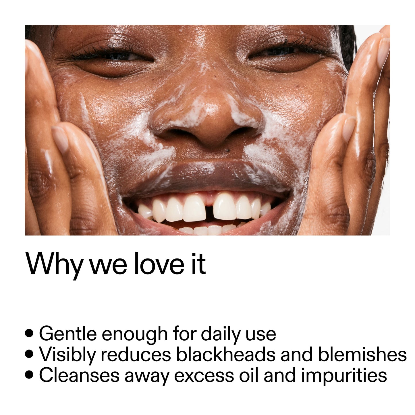 salicylic-acid-cleanser-duo-h9 Salicylic_Acid_Cleanser_-_300mlWhy_we_love_it_2000x2000_87dc92a9-2559-4309-98cd-4e570f1be735.jpg