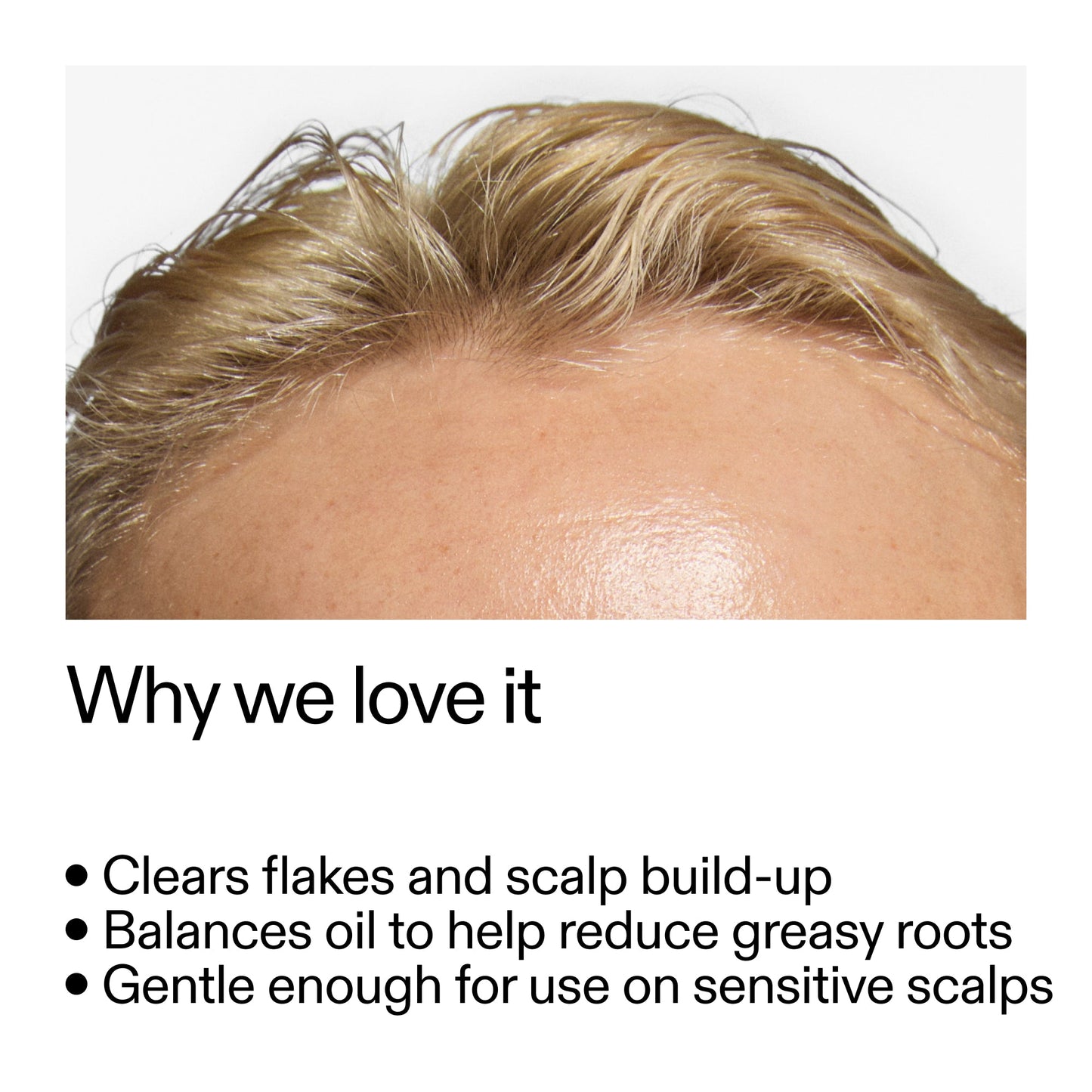 salicylic-acid-exfoliating-scalp-treatment-r4 Salicylic_Acid_Exfoliating_Scalp_Treatment_Why_we_love_it_2000x2000_44b6bd6d-9ec4-4b23-9dc4-bc3fd6f28e14.jpg