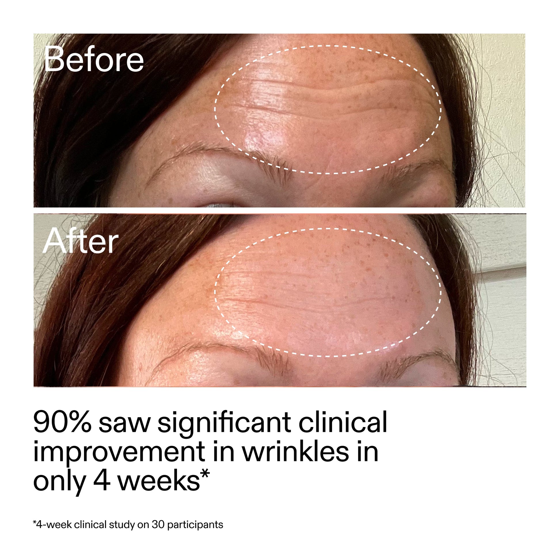 starter-retinol-serum-duo-f3 StarterRetinol_BeforeAfter_Claim1_2000x2000_03b4d6e5-a357-43b9-a855-aba5e35c57f3.jpg