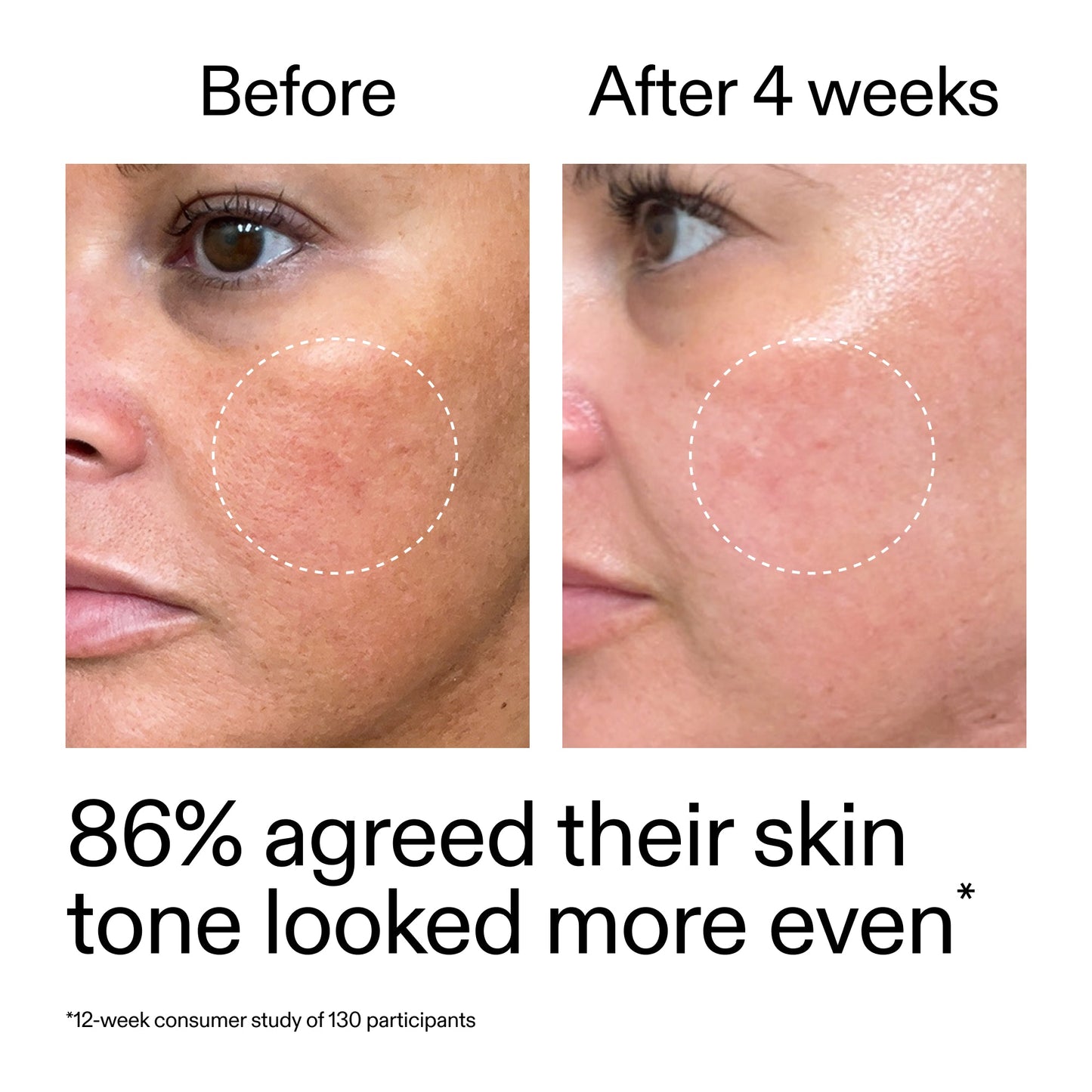 starter-retinol-serum-duo-f3 StarterRetinol_BeforeAfter_Claim2_2000x2000_fc5bb8ac-8588-478f-98d5-28af6651601a.jpg