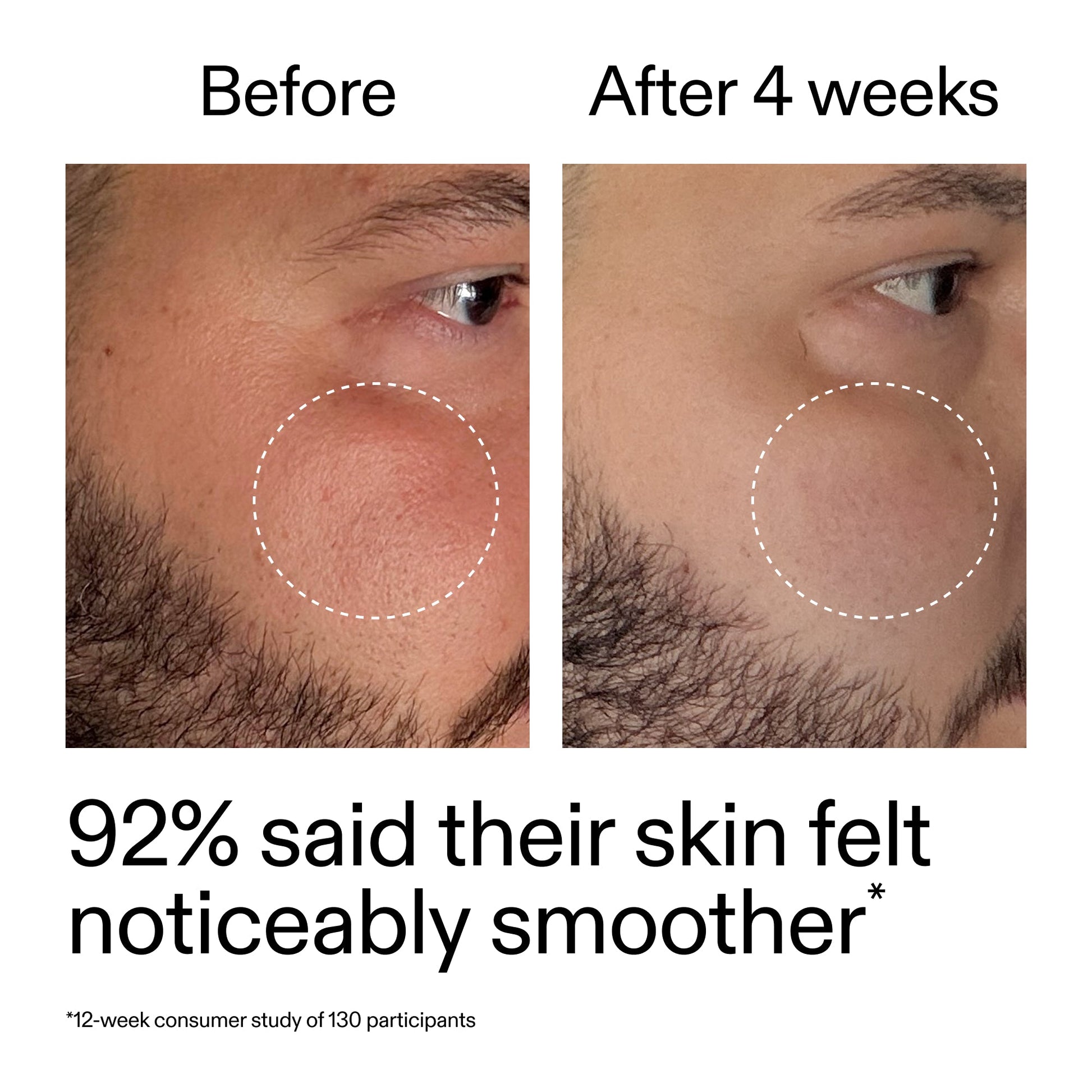starter-retinol-serum-duo-f3 StarterRetinol_BeforeAfter_Claim3_2000x2000_458243a8-bbb0-4e5d-a274-29c7766d339b.jpg