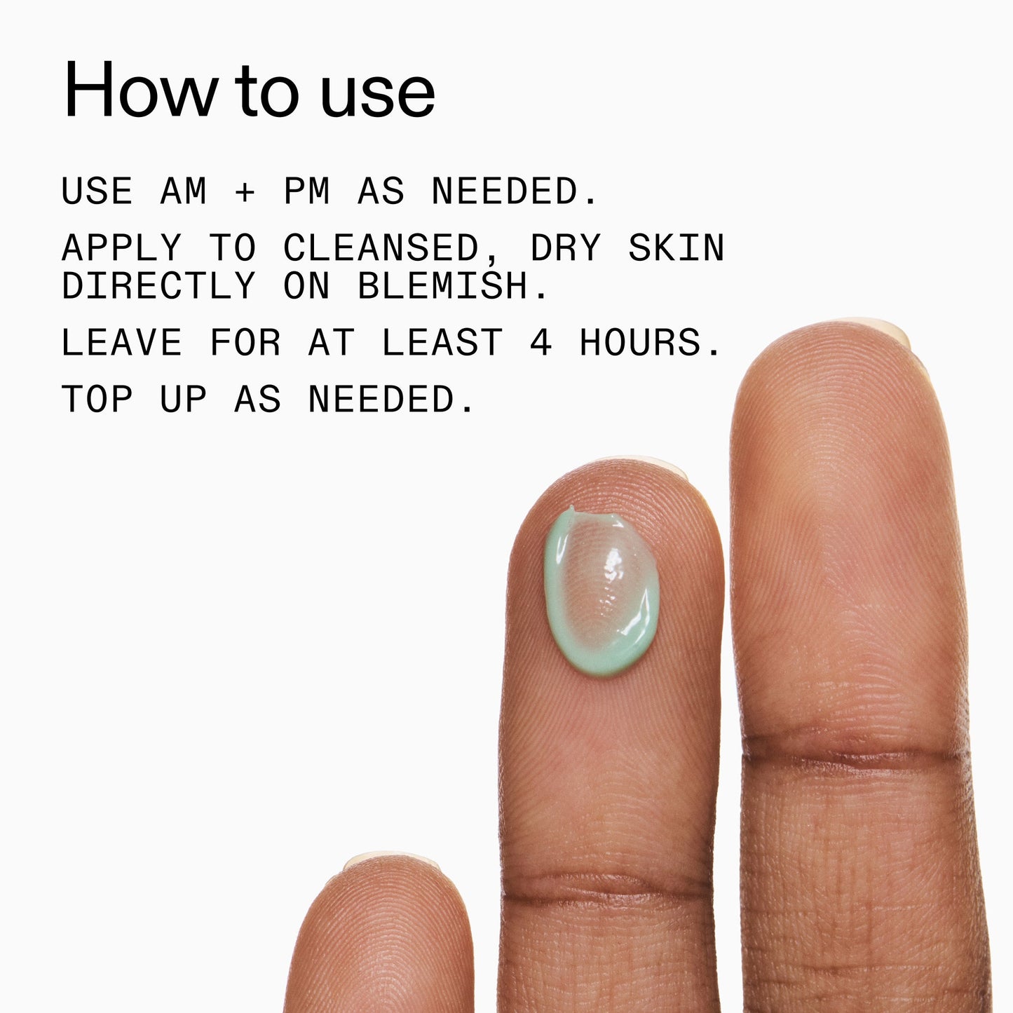 succinic-acid-acne-treatment-k3 Succinic_Acid_Treatment_How_to_Use_2000x2000_d57137d5-d7f1-427c-9a46-5fc00c19c542.jpg