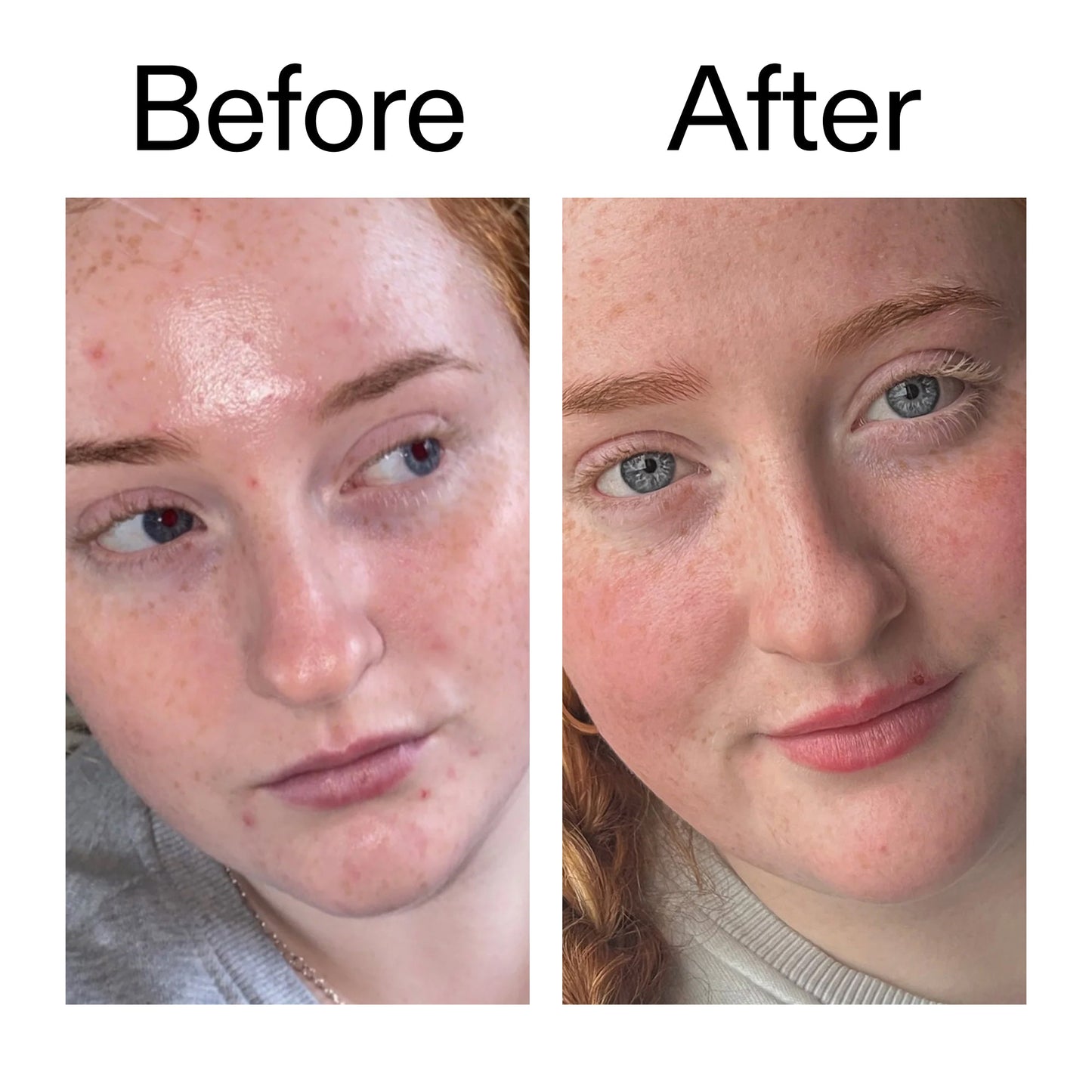 vitamin-b-c-and-e-moisturizer-c2 Vitamin_B_C_and_E_Moisturizer_Before_After_2000x2000_b0781a76-5ad2-4be9-95b8-ef92b356833c.jpg